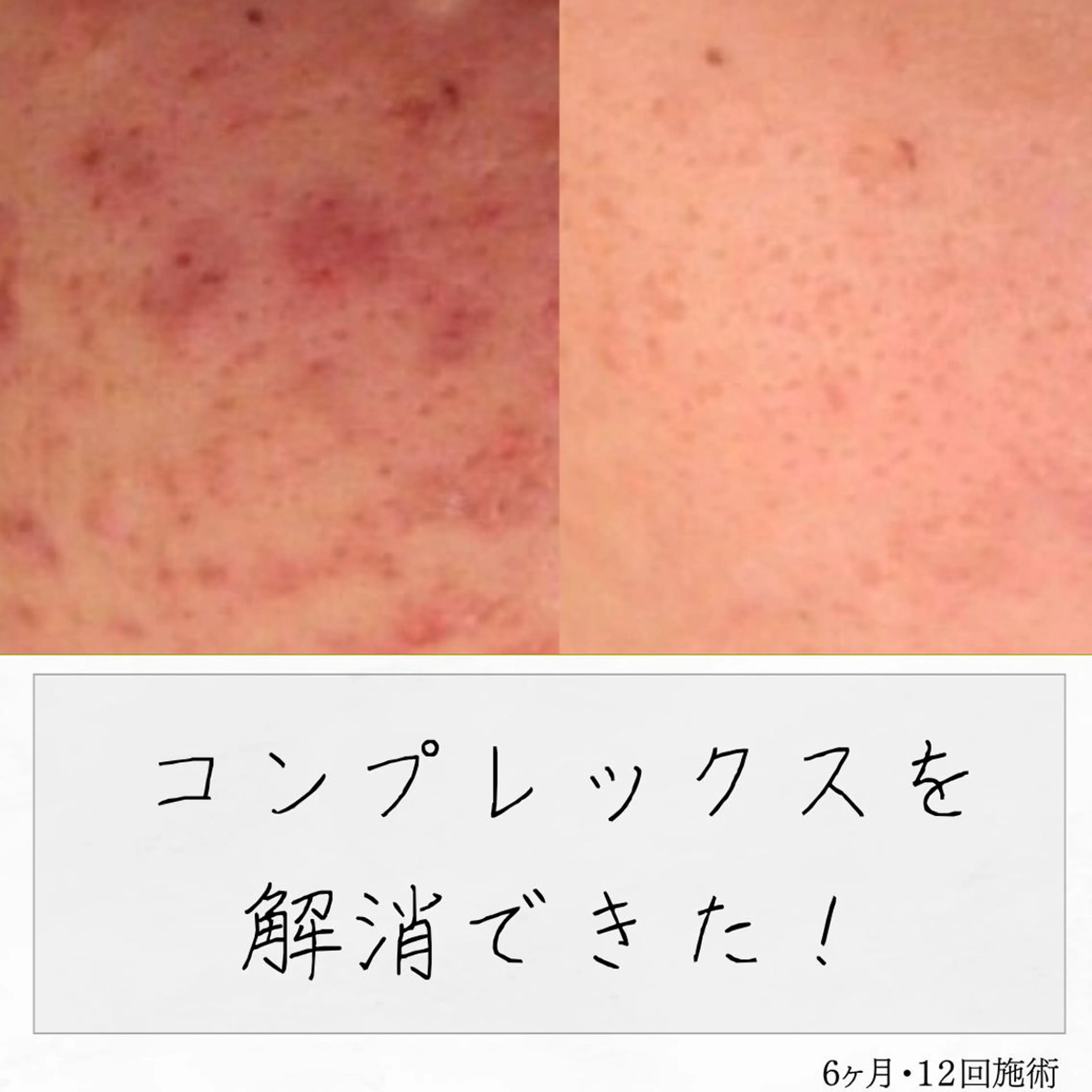 ニキビ経験者が施術 する専門サロン🌻のエステ・リラクイメージ