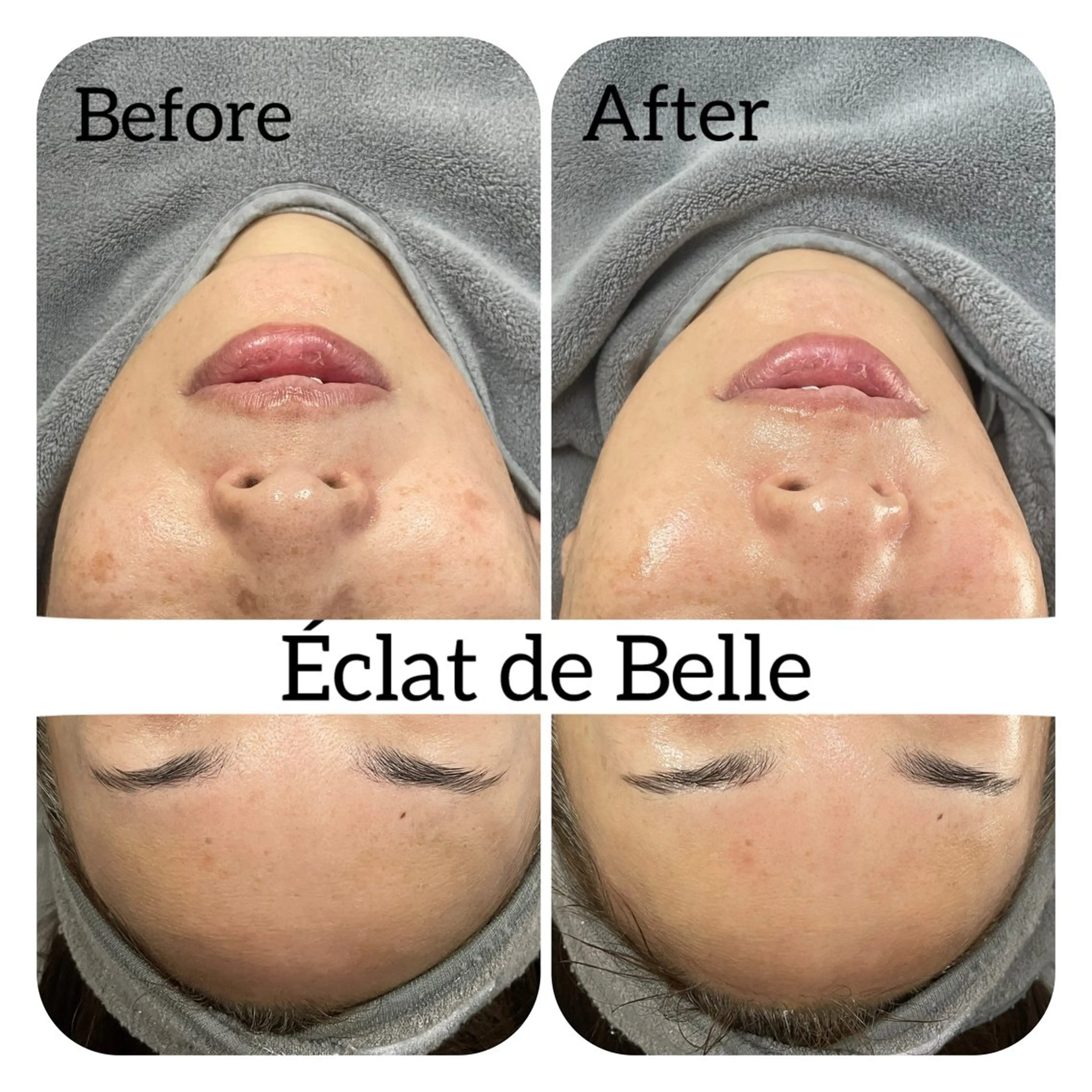 エステ Éclat de Belle🫧白玉肌のその他イメージ