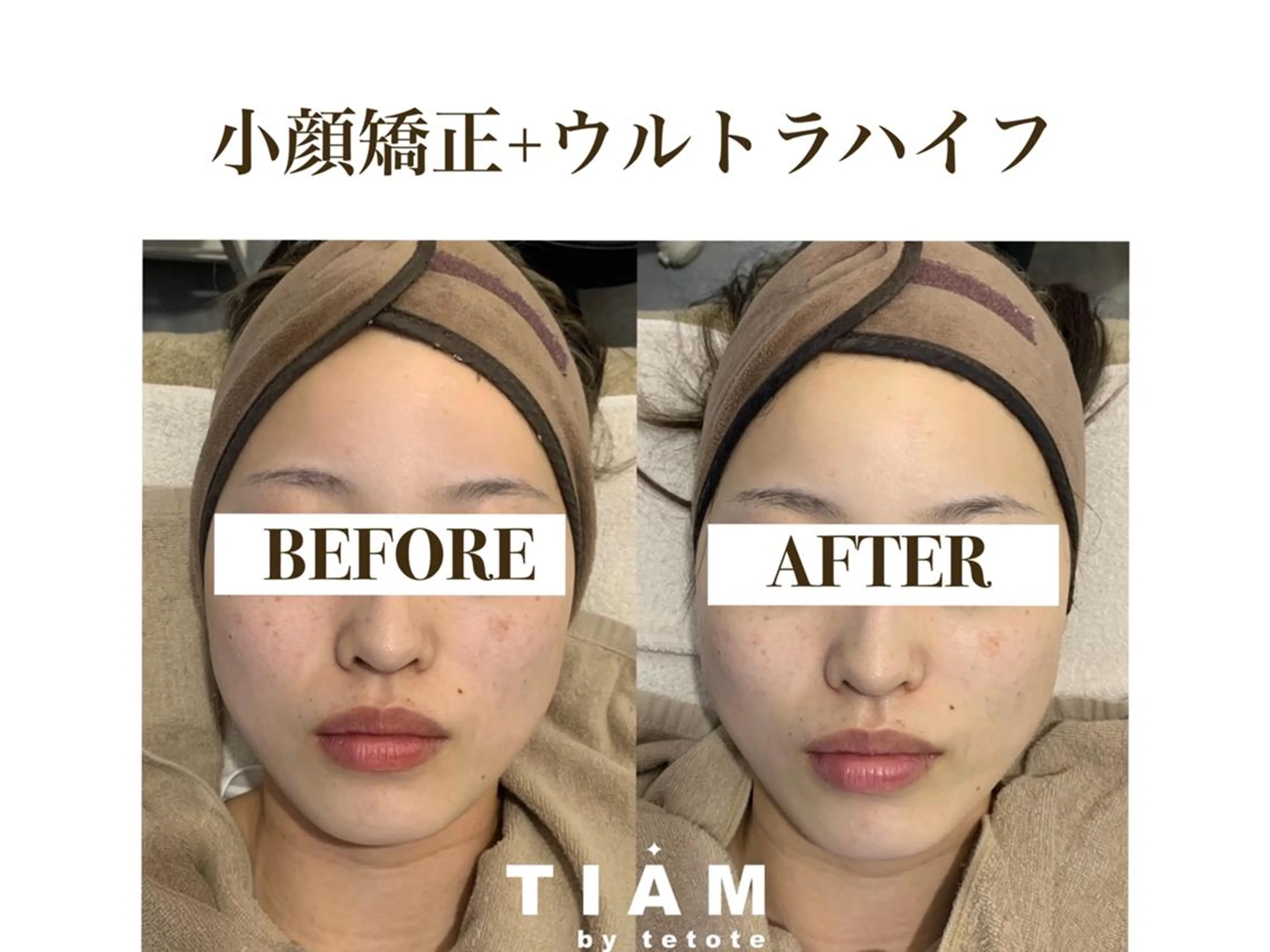 美肌サロンTIAM by tetoteのエステ・リラクイメージ