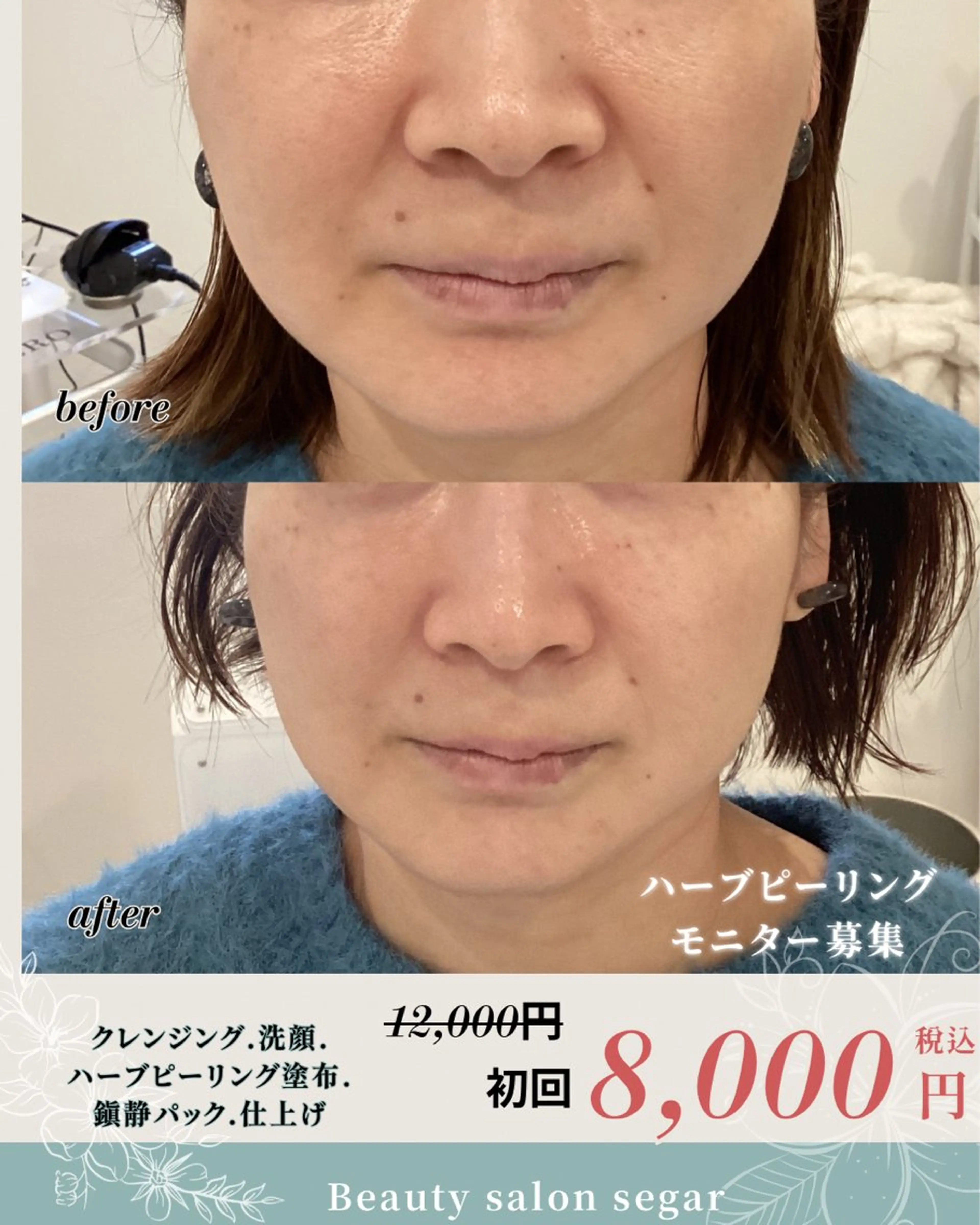 エステ segar 菅野枝里子のエステ・リラクイメージ