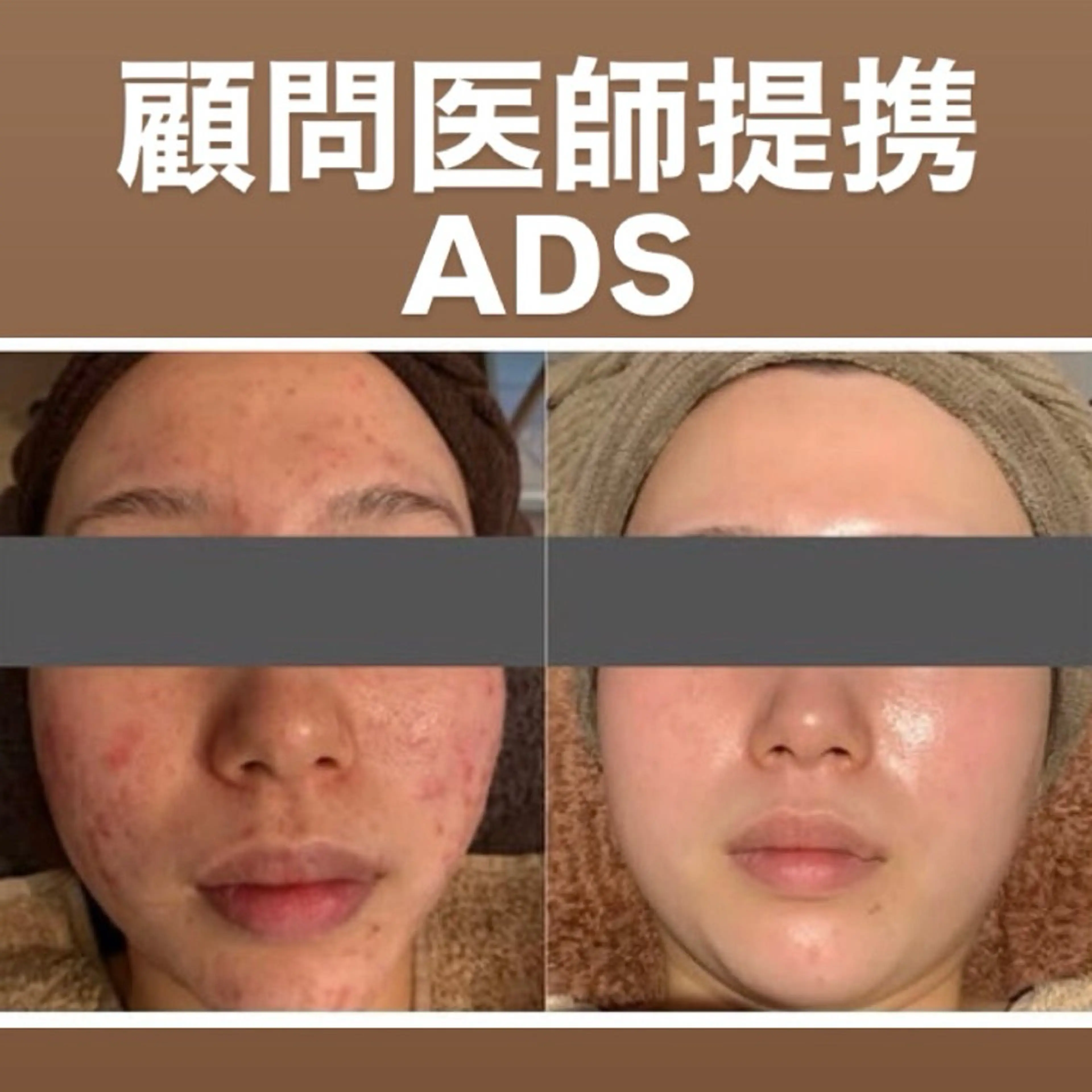 堀江リンパマッサージ 肩こり/リンパ/小顔のエステ・リラクイメージ