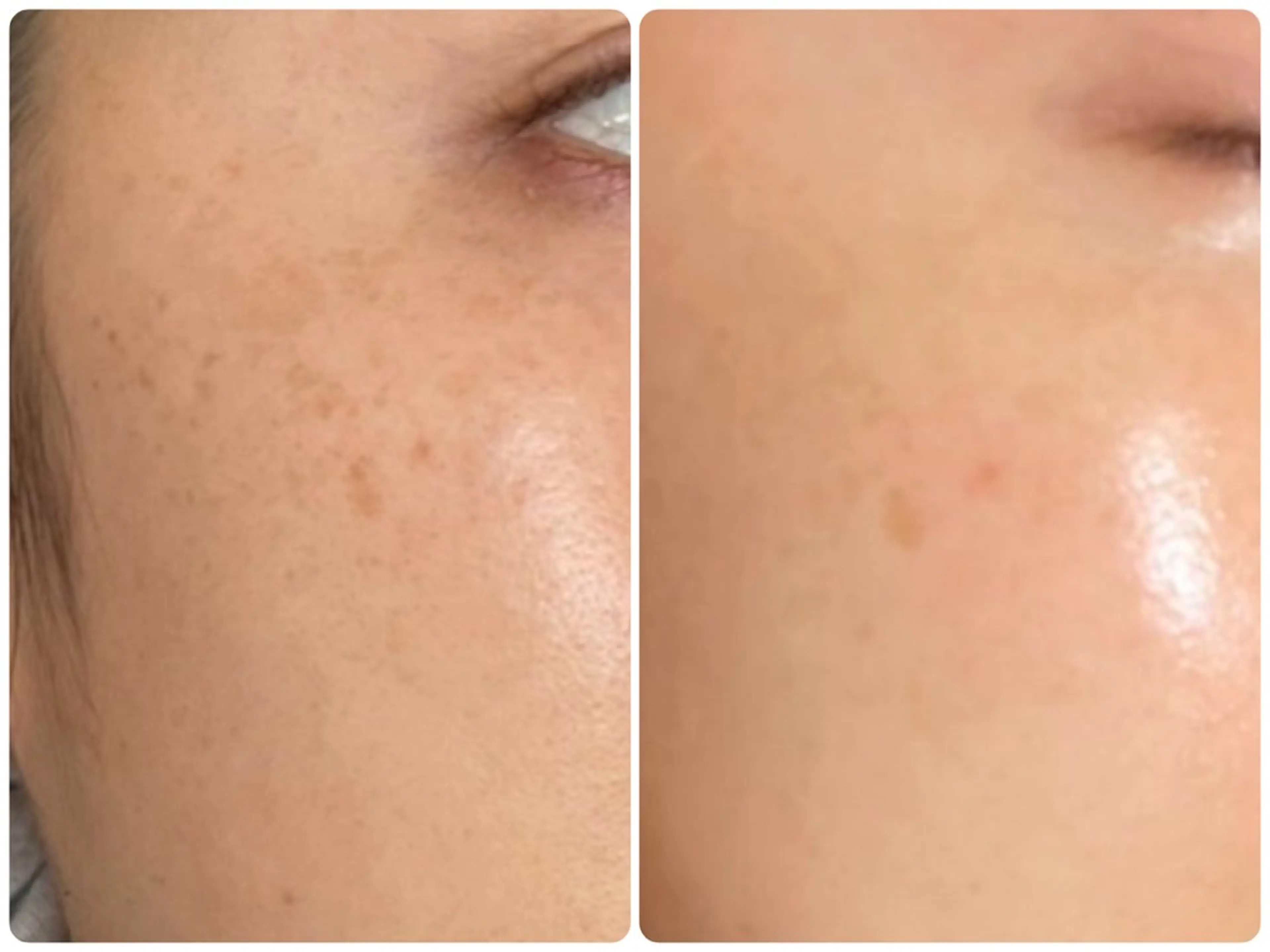 イデアルMe♡ NAKAMURAのその他イメージ