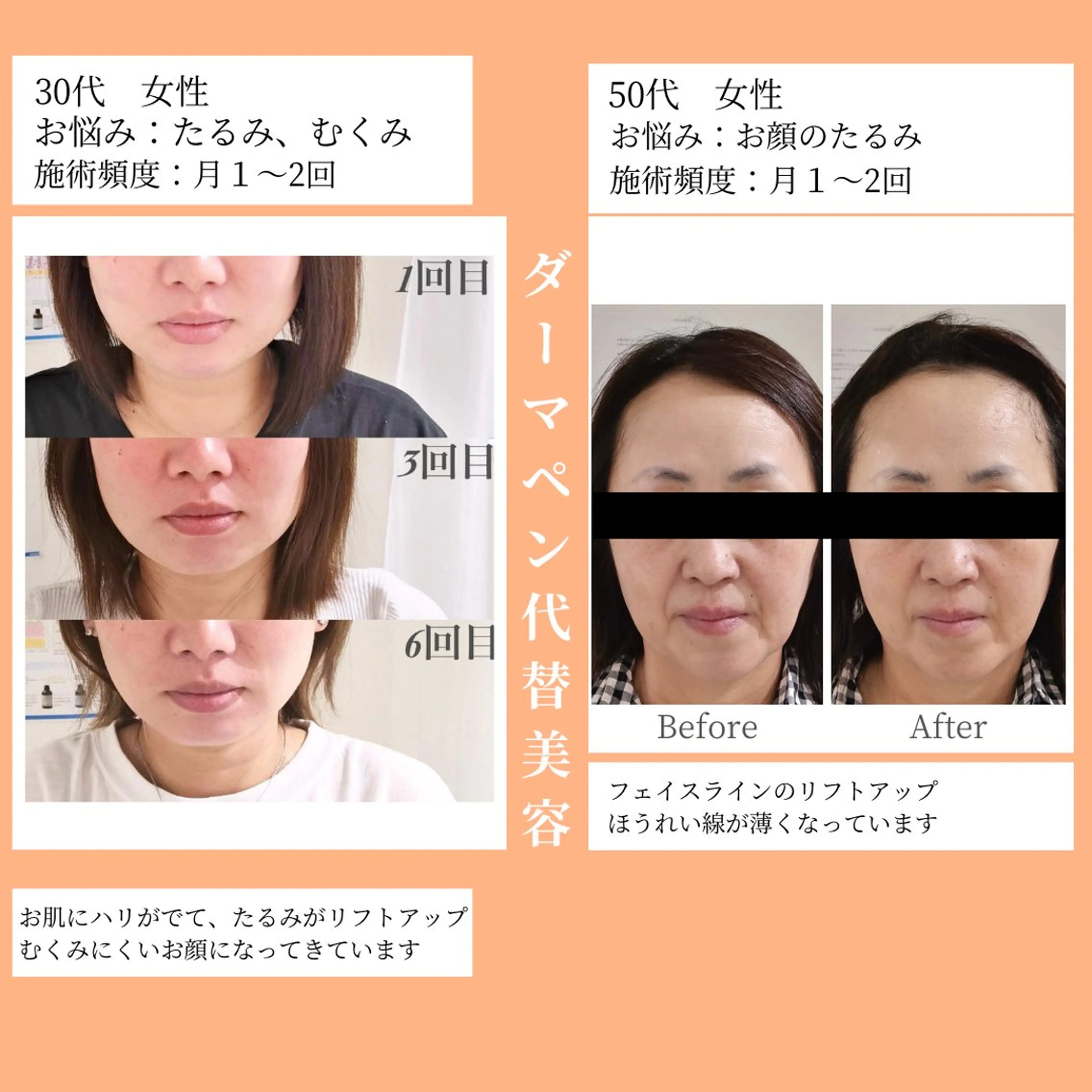 小顔・ツルツル素肌 ハリステリアのエステ・リラクイメージ