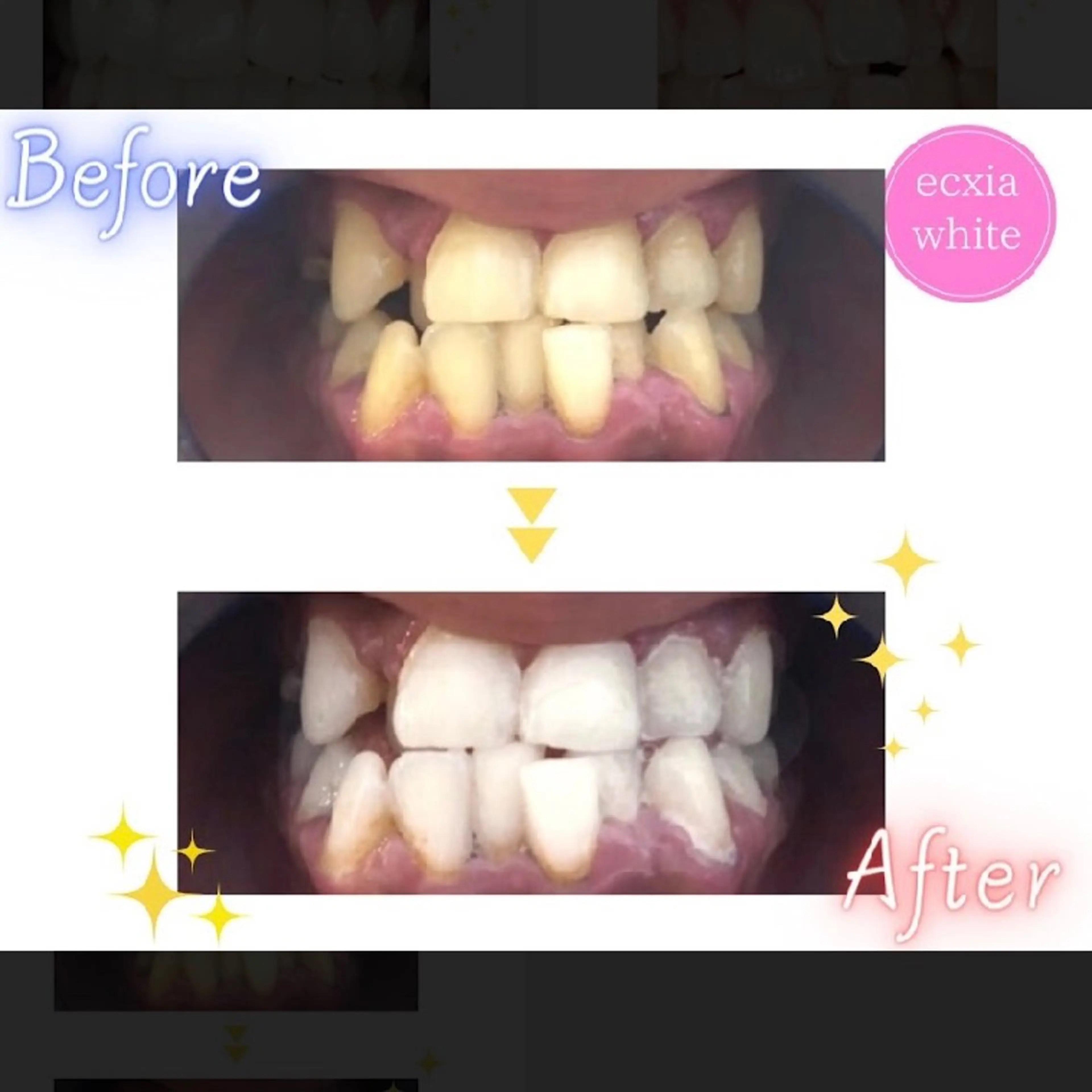 nanami -ホワイトニングのその他イメージ