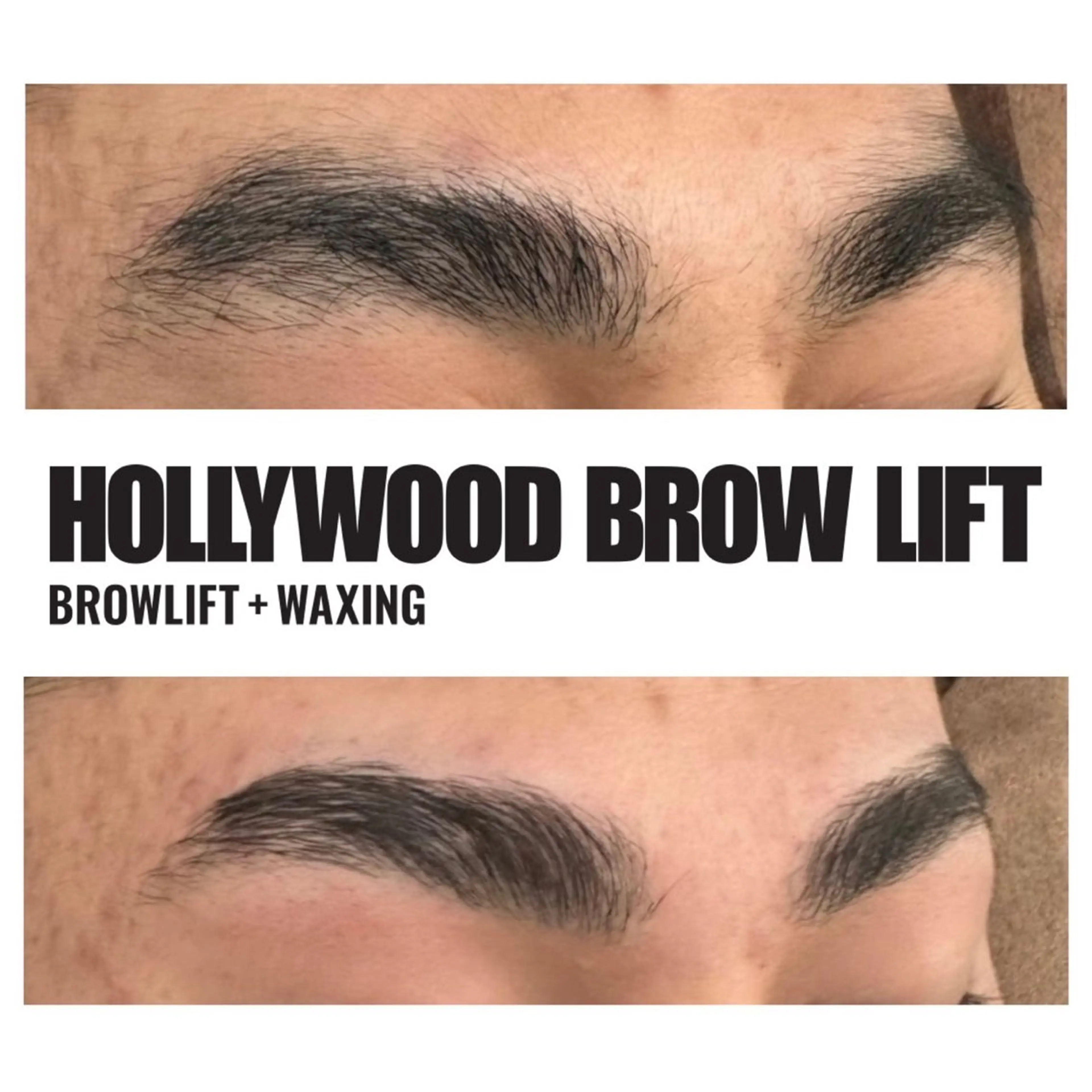 アイブロウ ワックス脱毛 その他(アイブロウ) 小顔矯/美容鍼/鍼灸 BeauJuのその他イメージ