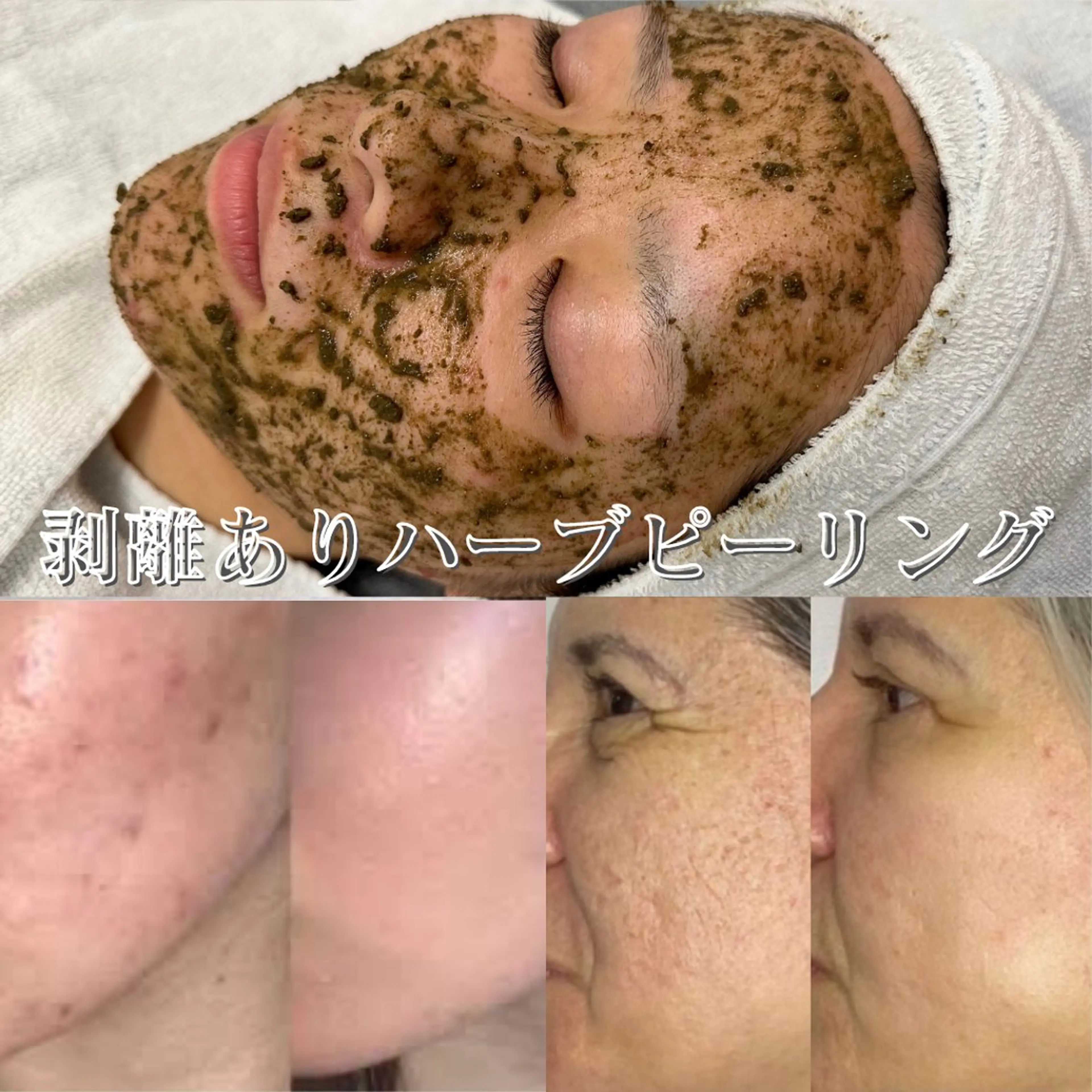 エステ BestBelleꕤ 大阪福島/肌質改善のエステ・リラクイメージ