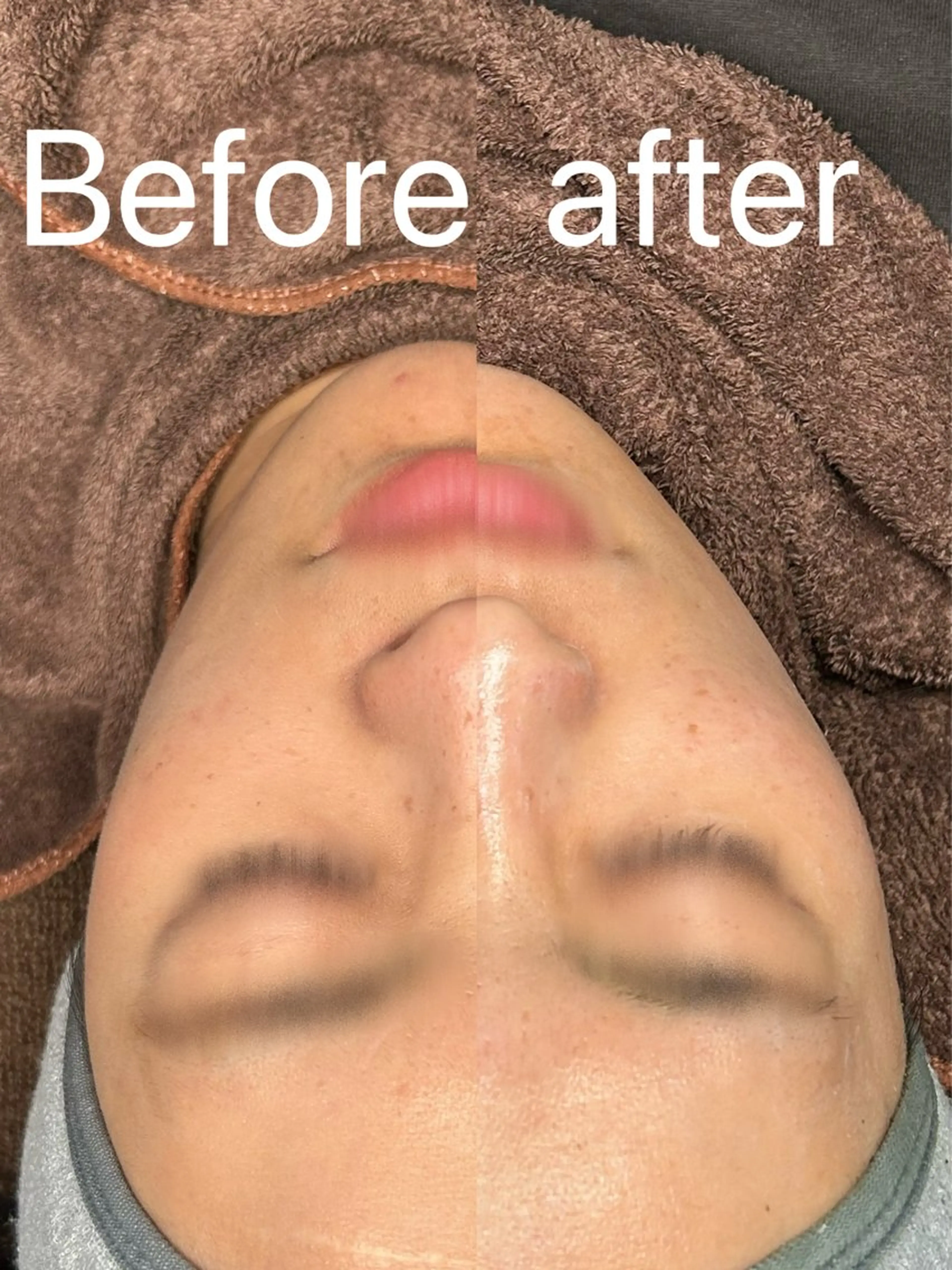 エステ Smoo アユミの眉毛・アイブロウイメージ