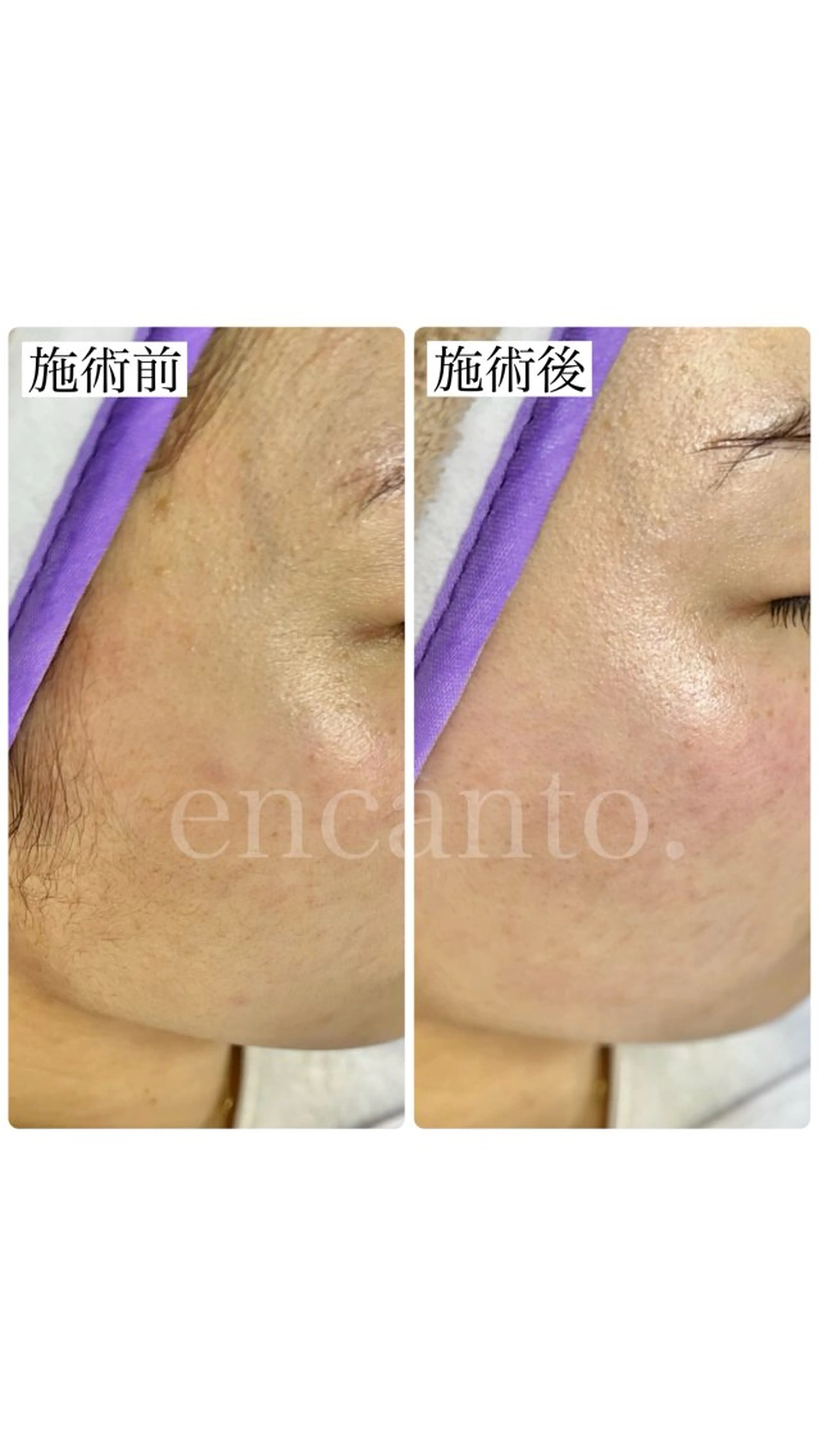 エステ 杉本 里保のその他イメージ