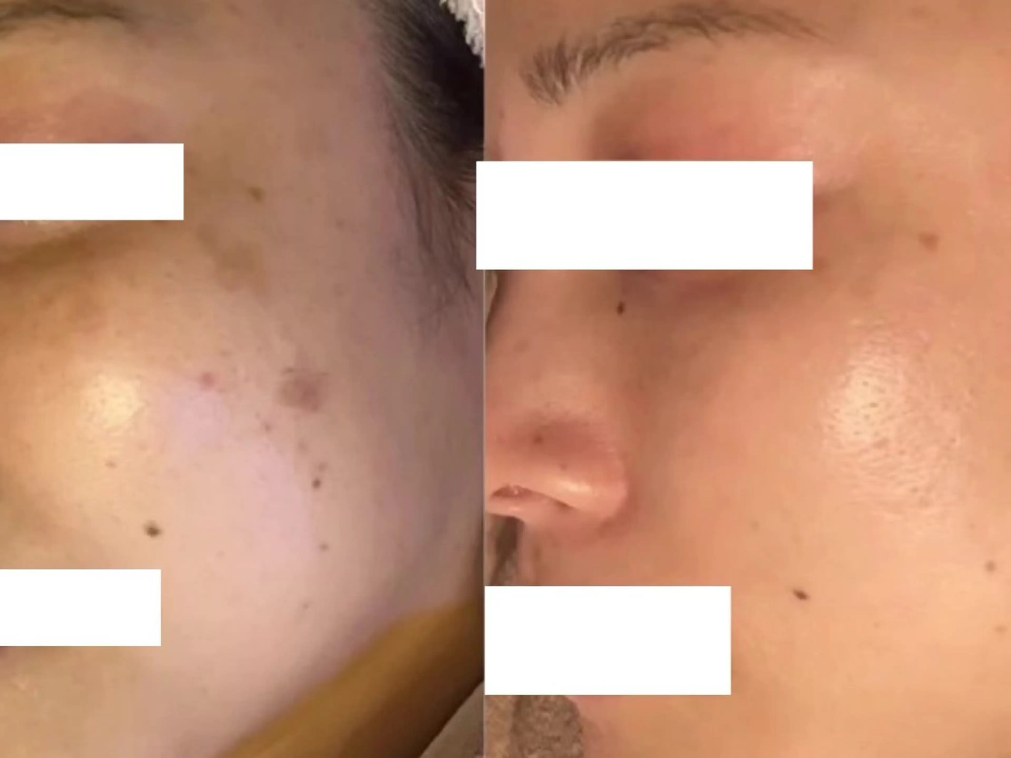 エステ シミケア専門サロンLICCO’S所属・シミケア専門サロン LICCO’S岡崎のエステ・リラクイメージ