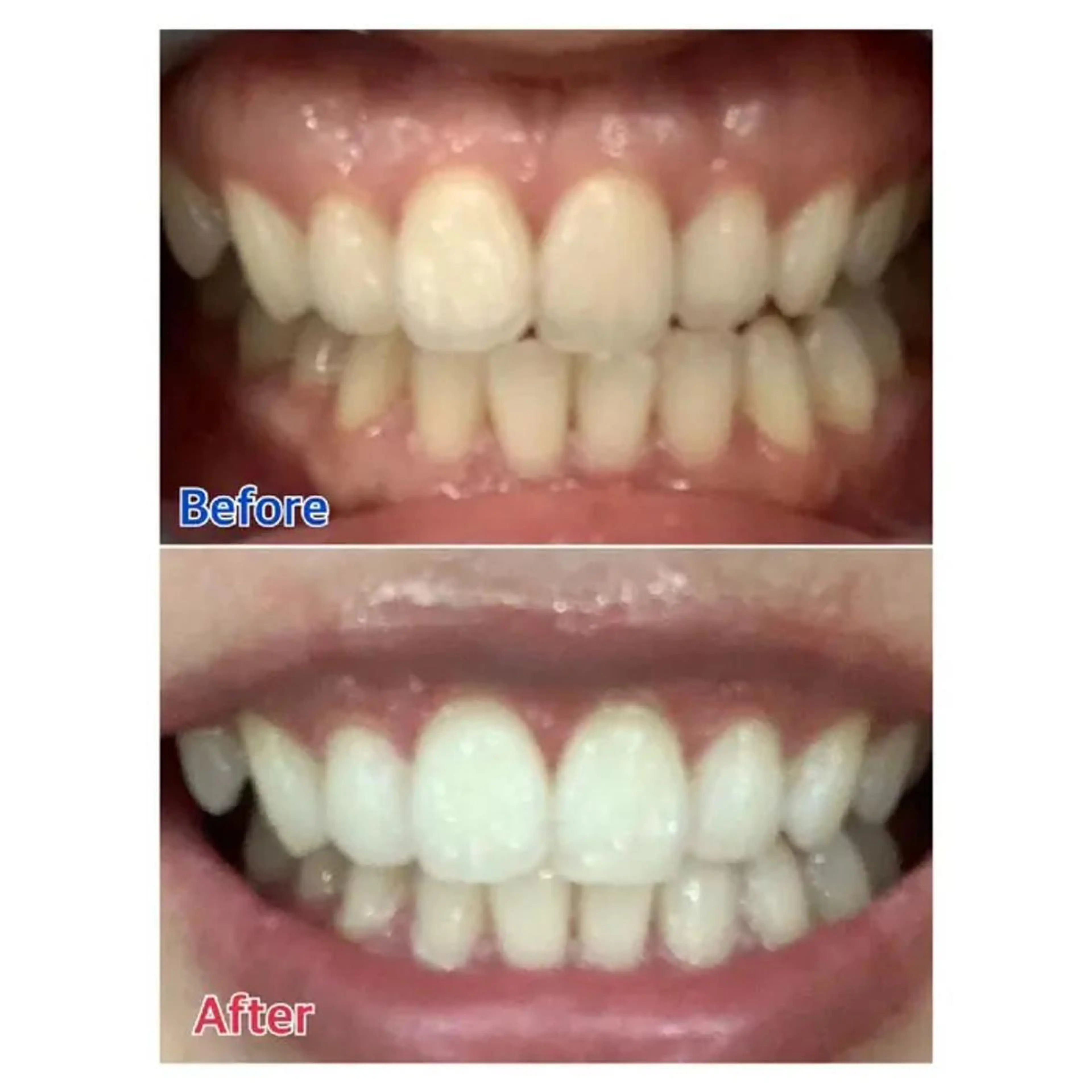 M渋谷 ホワイトニングのその他イメージ