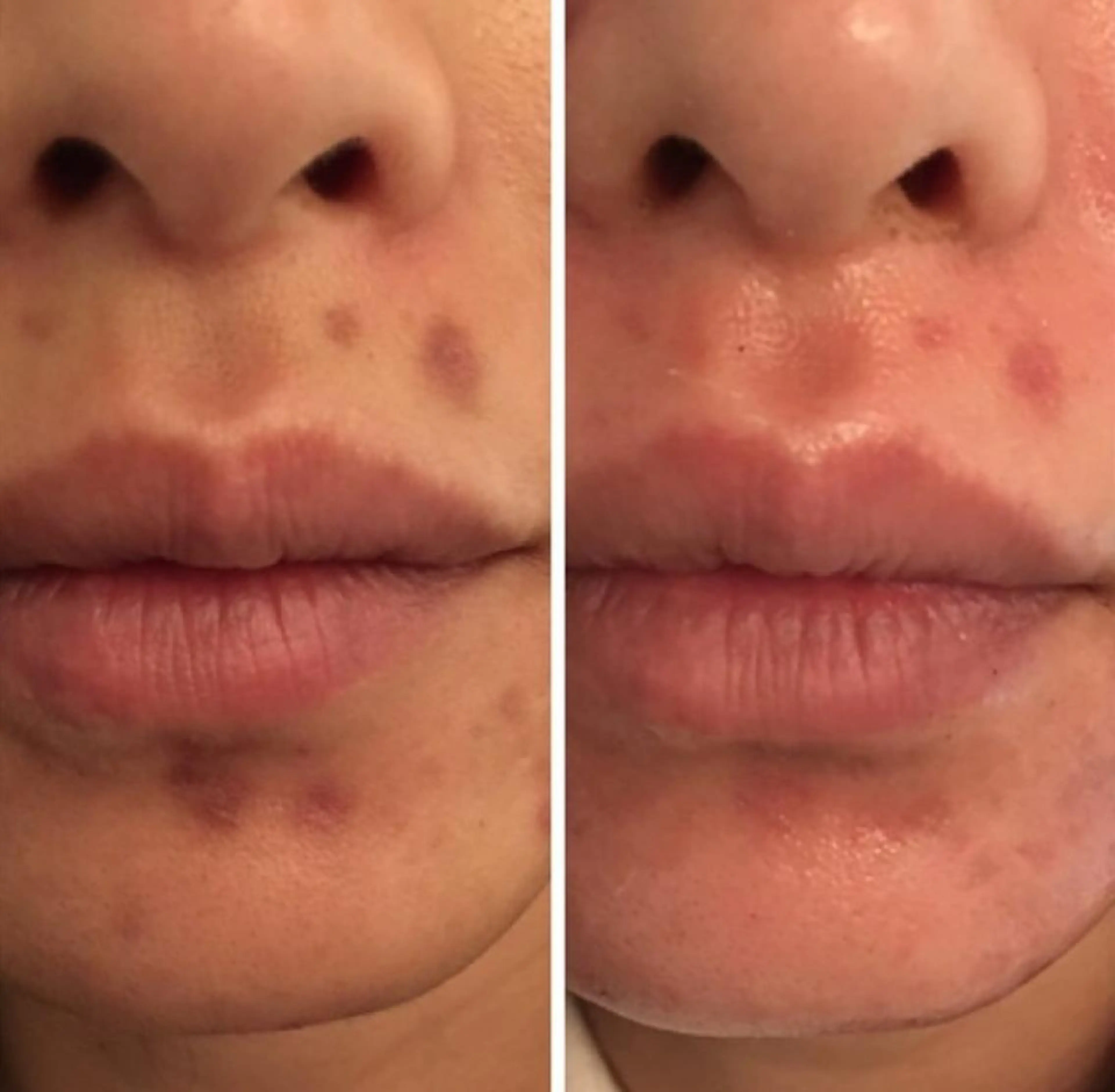 体質・肌質改善サロン アンシャンテのエステ・リラクイメージ