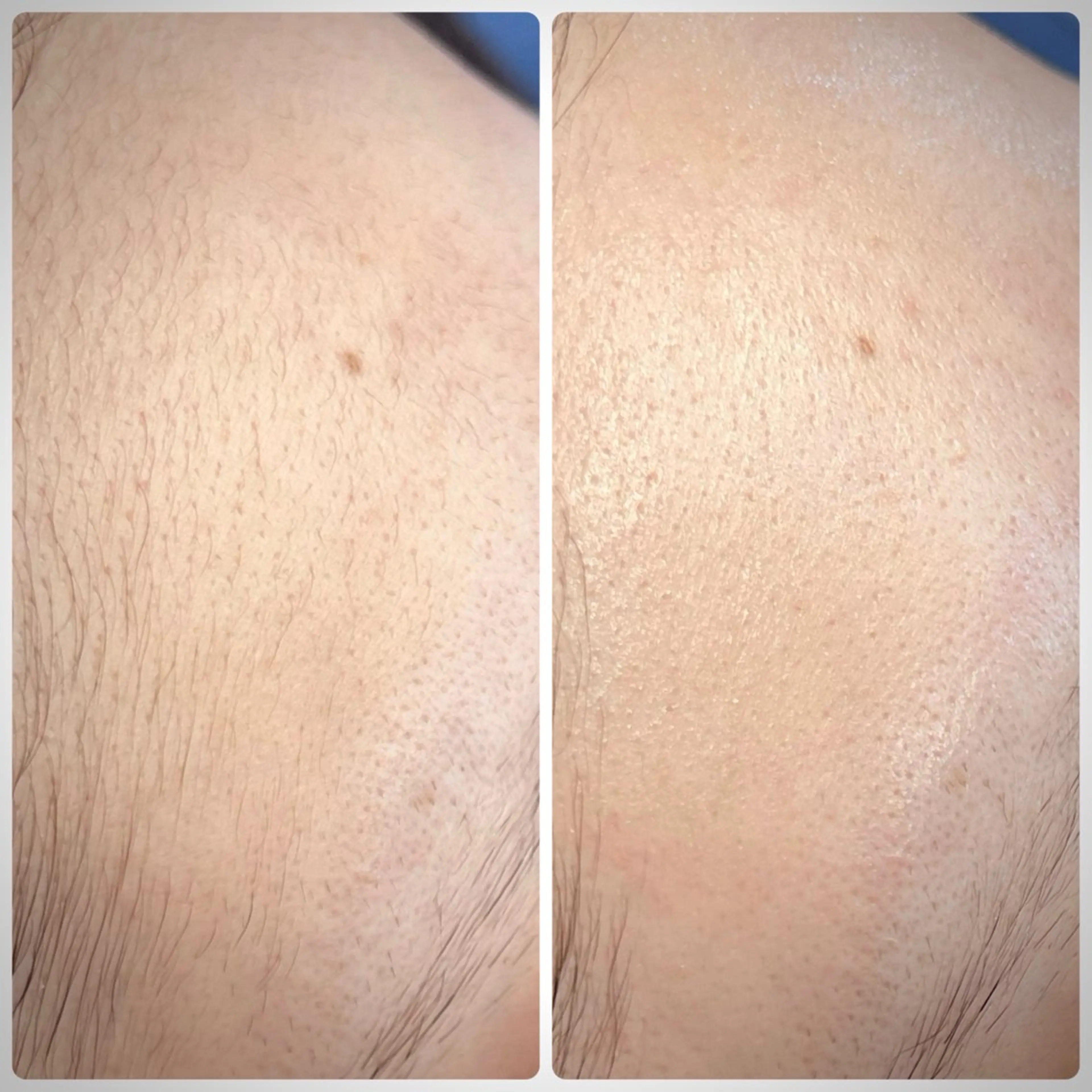 脱毛 Muqu.所属・Muqu. 毛穴サロンのエステ・リラクイメージ