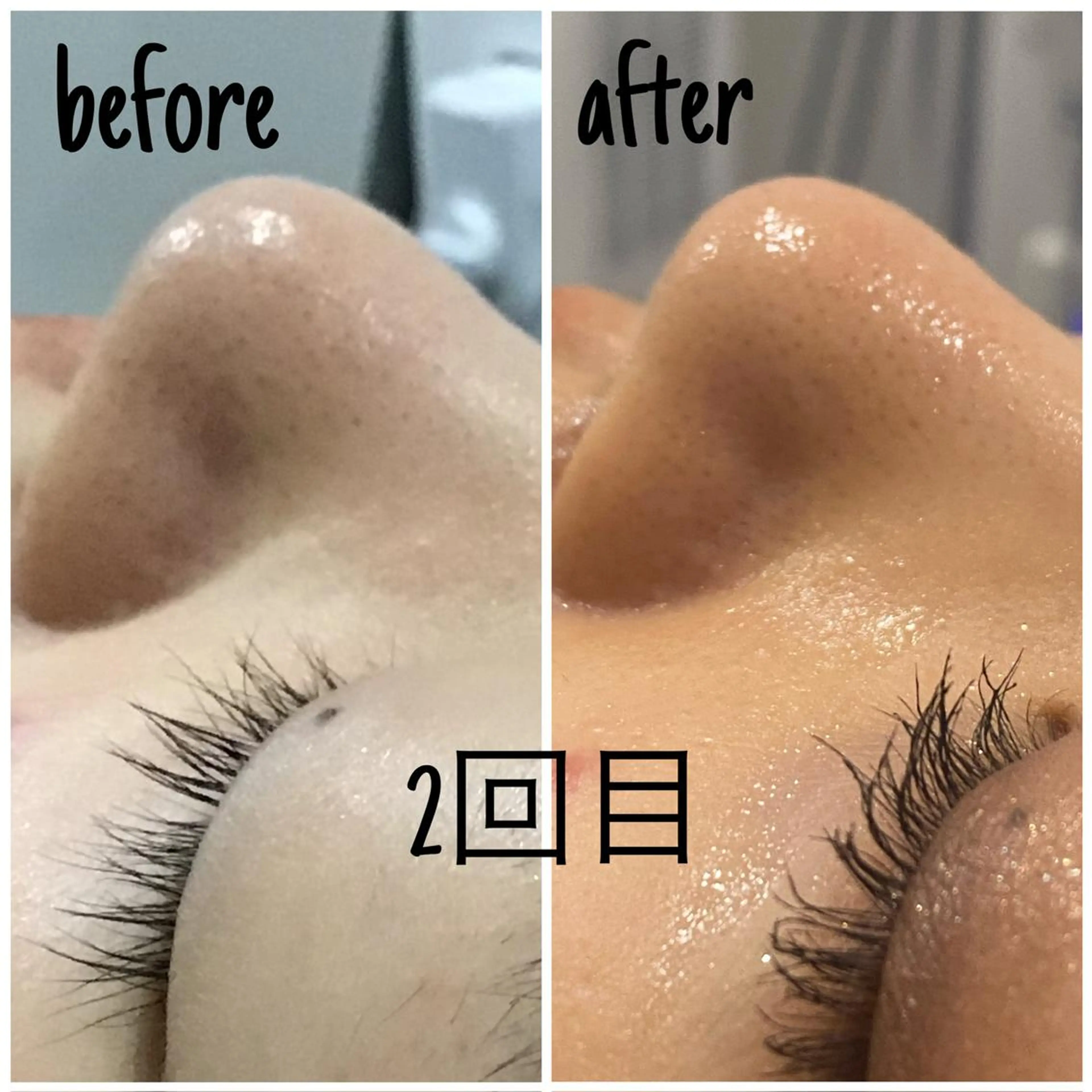 痩身/毛穴洗浄/脱毛 アルカンジュのエステ・リラクイメージ