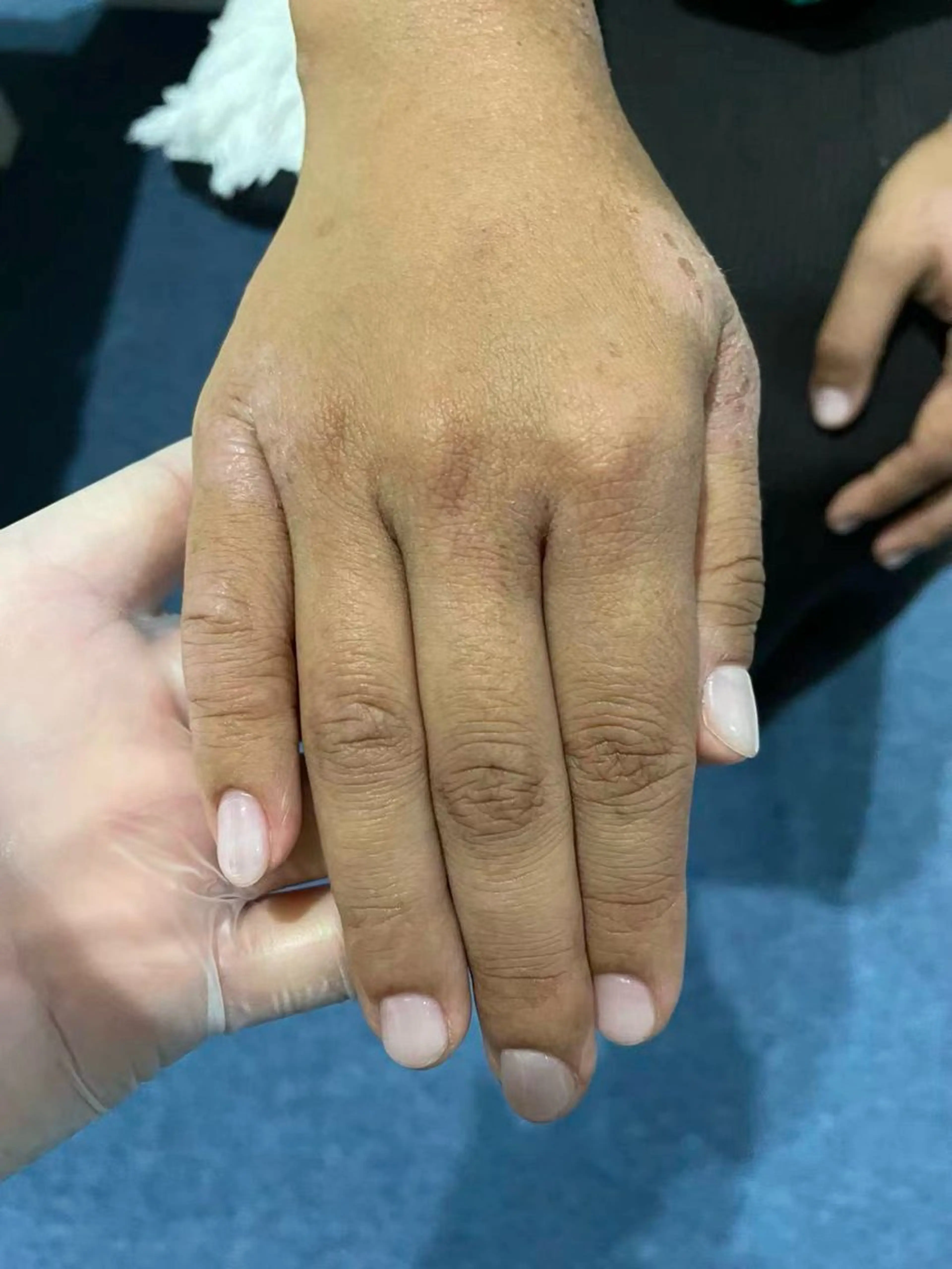 【迷ったらご相談を】カウンセリング＆最適なメニューをご提案→施術（75分）の写真