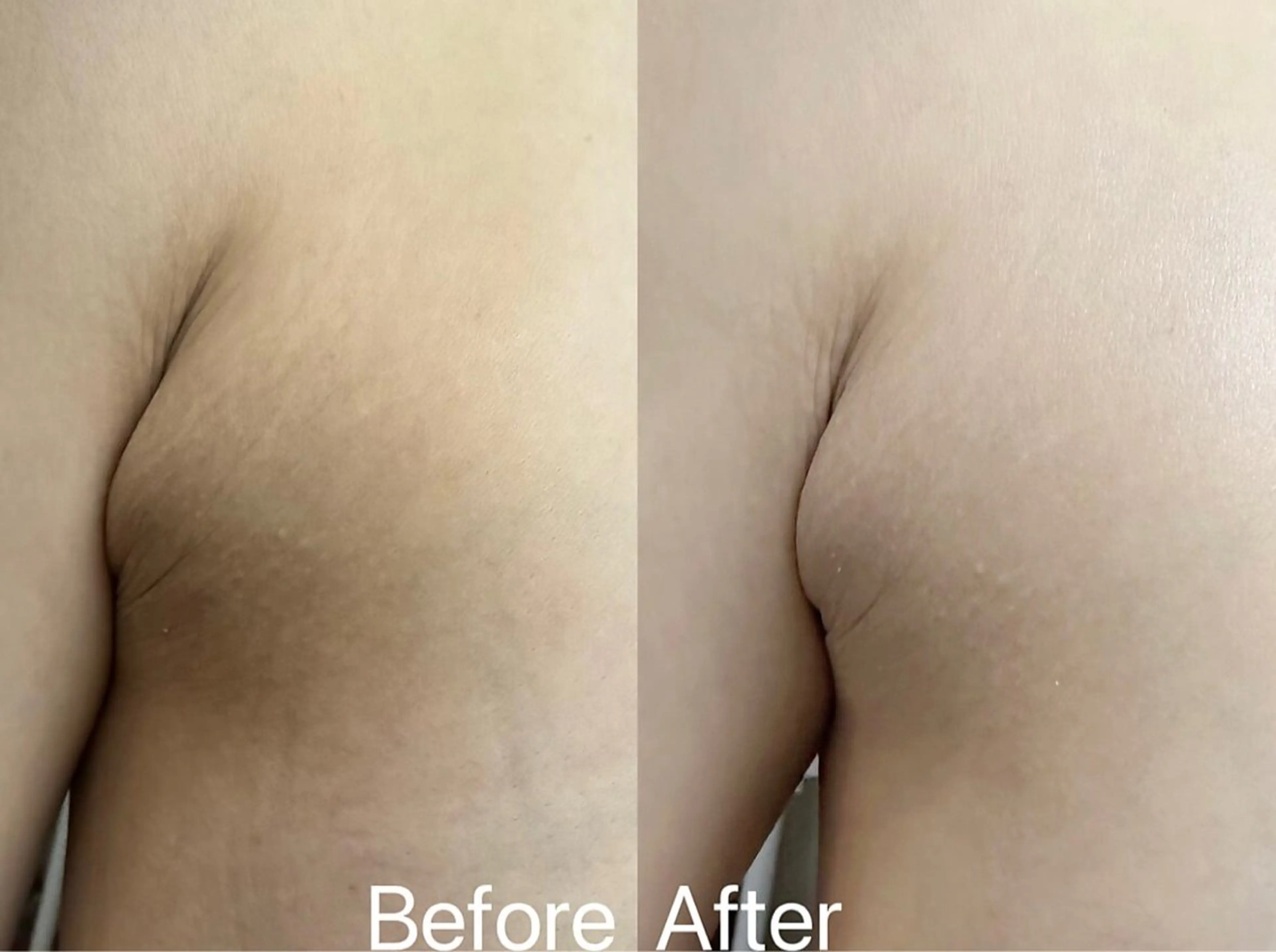 【女性限定★ボディの黒ずみ/毛穴/美白】幹細胞復元パック8gの写真