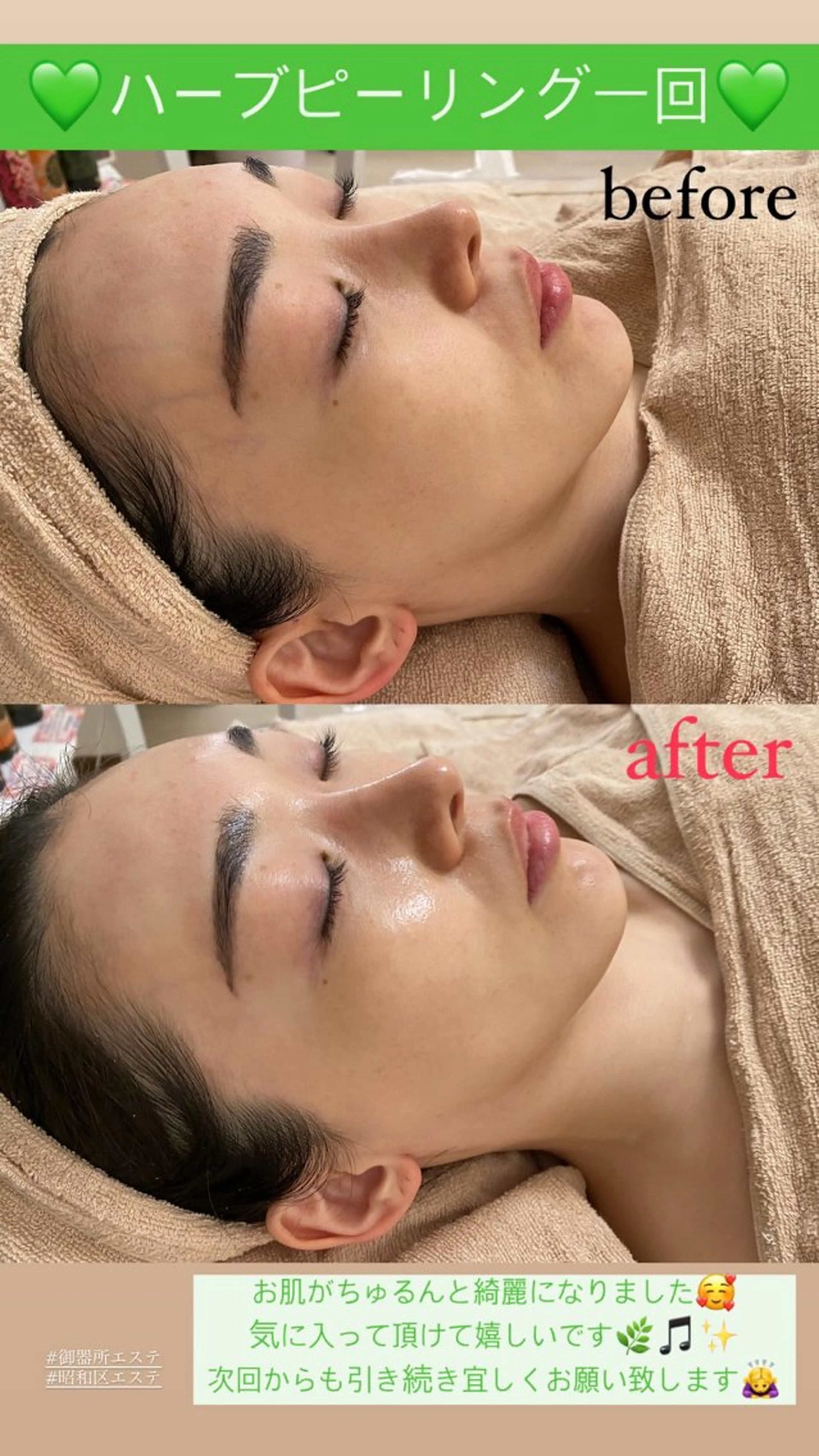 エステ Salon de Lino 御器所のエステ・リラクイメージ