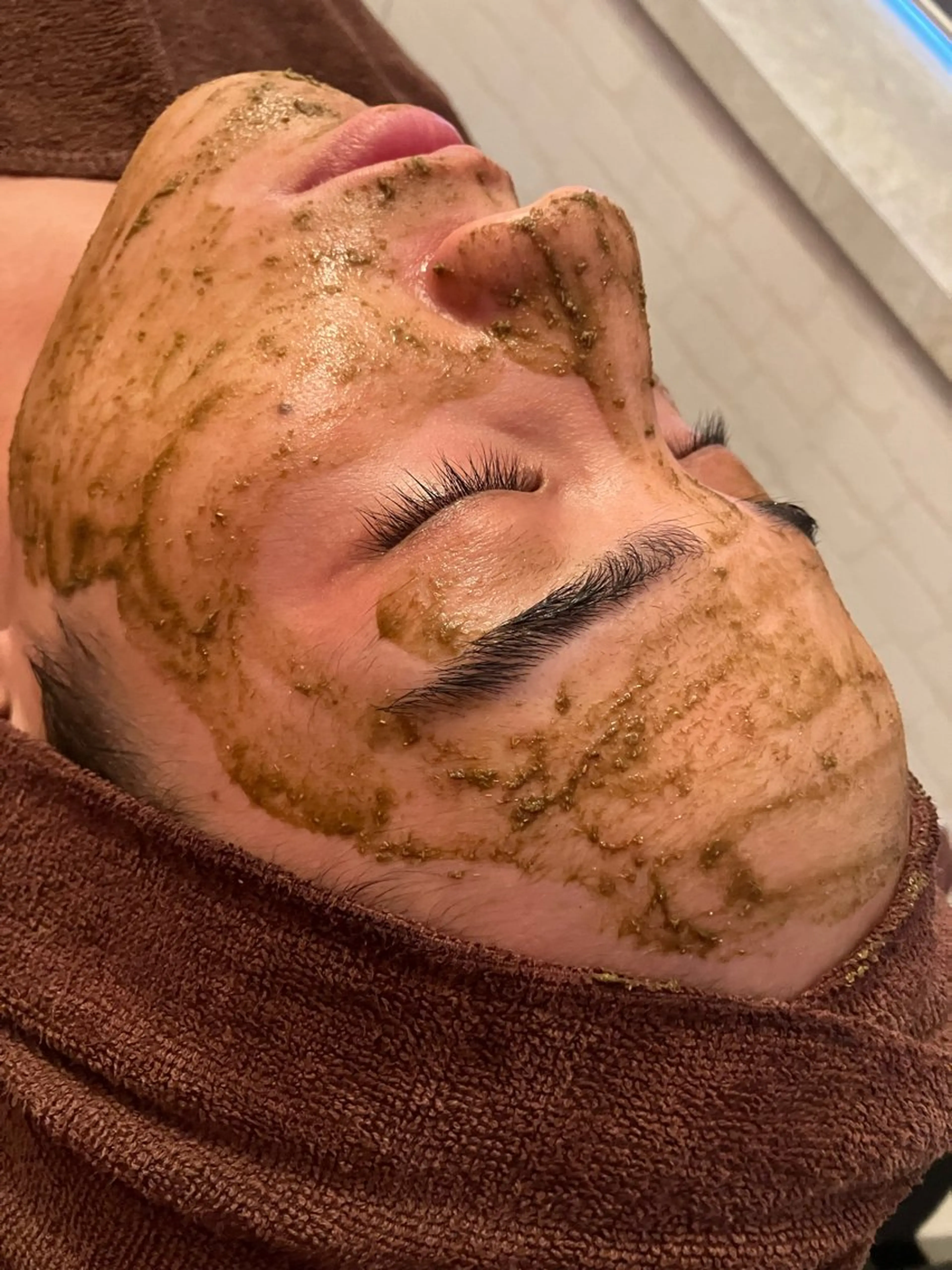 ◎ニキビ毛穴改善【毛穴洗浄付き！】ハーブ🌿ピーリングの写真