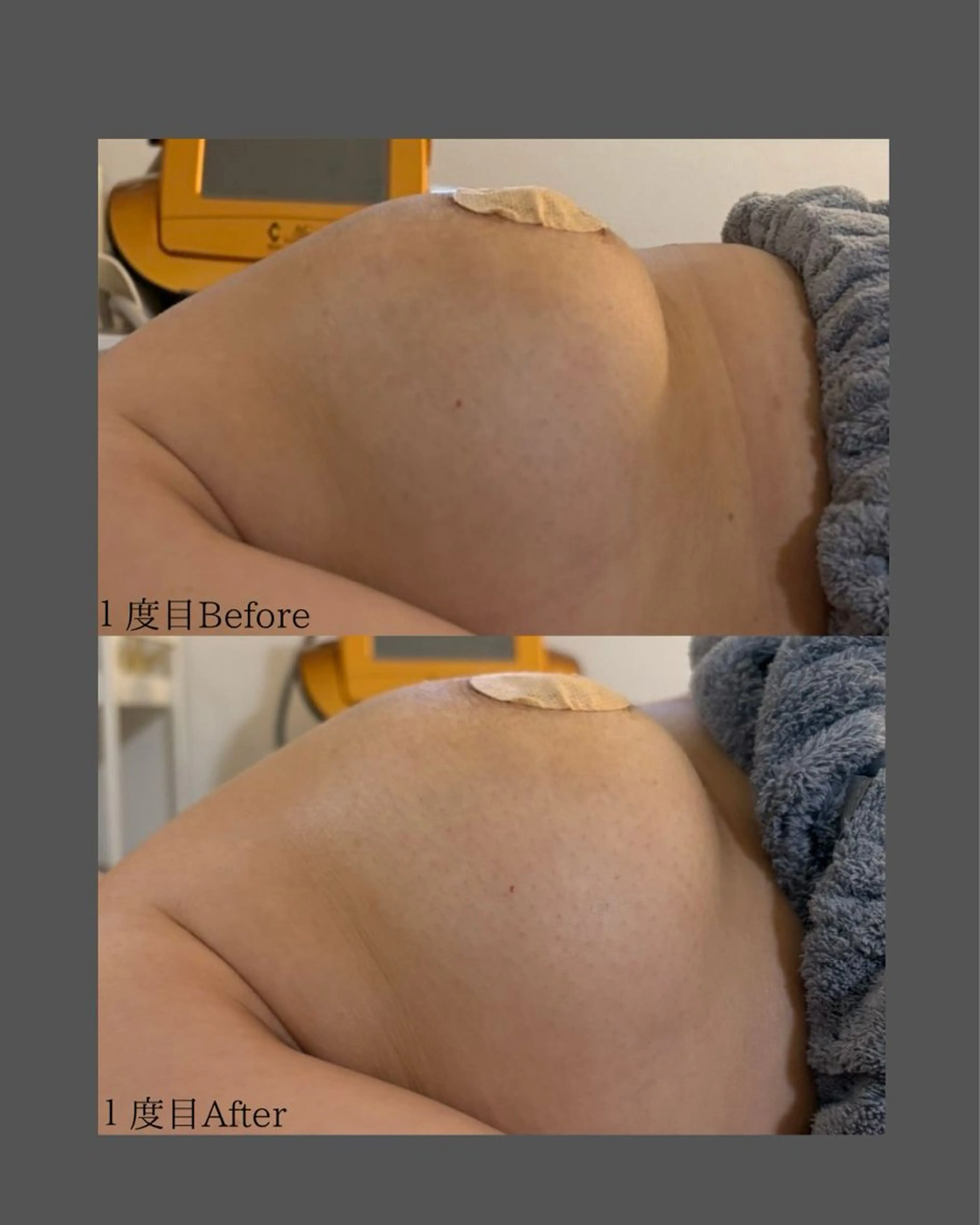 その他 BLOSSOM 菊地のエステ・リラクイメージ