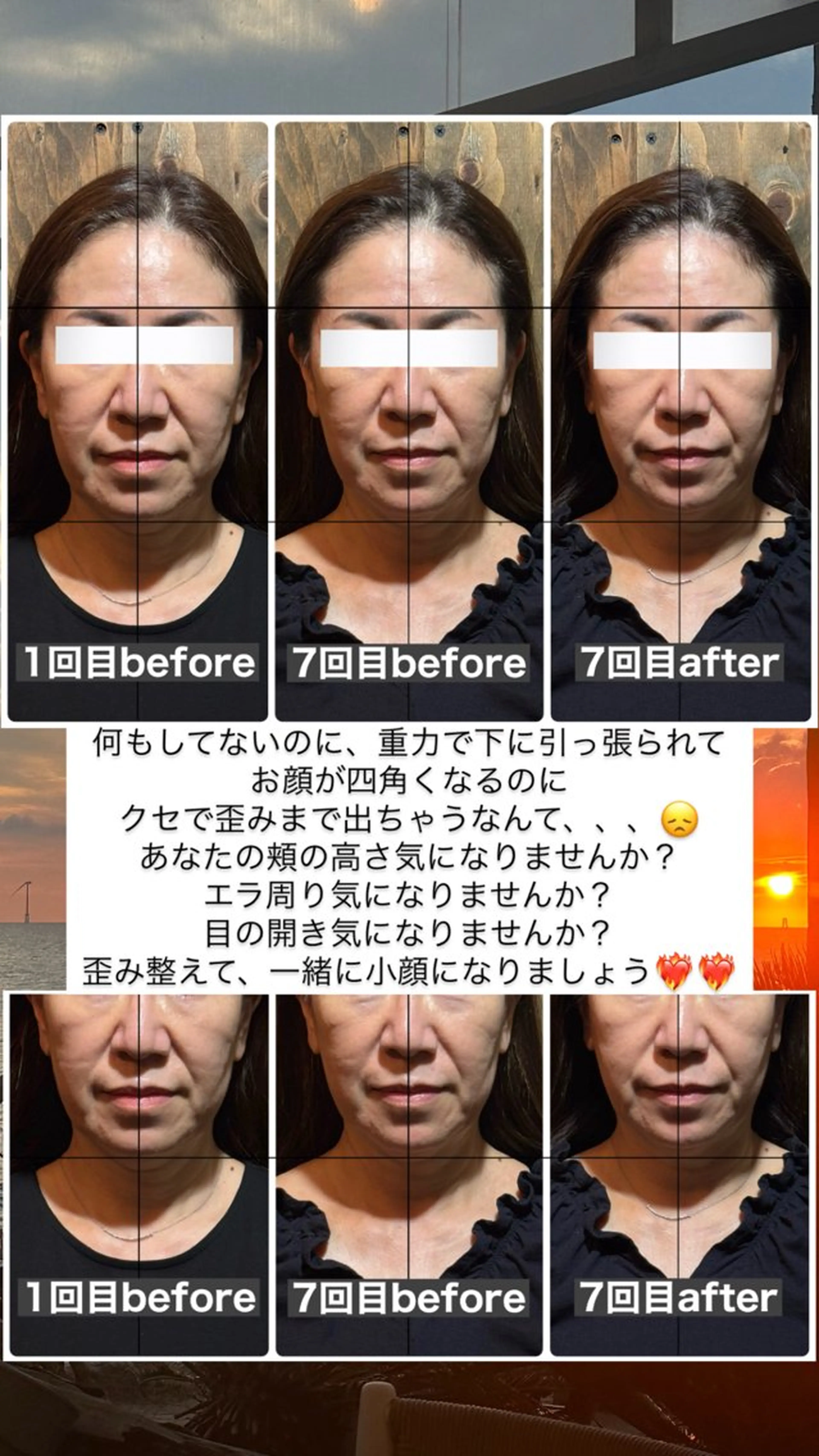 💎後悔させない小顔 矯正💎イトヤマ🌱のエステ・リラクイメージ