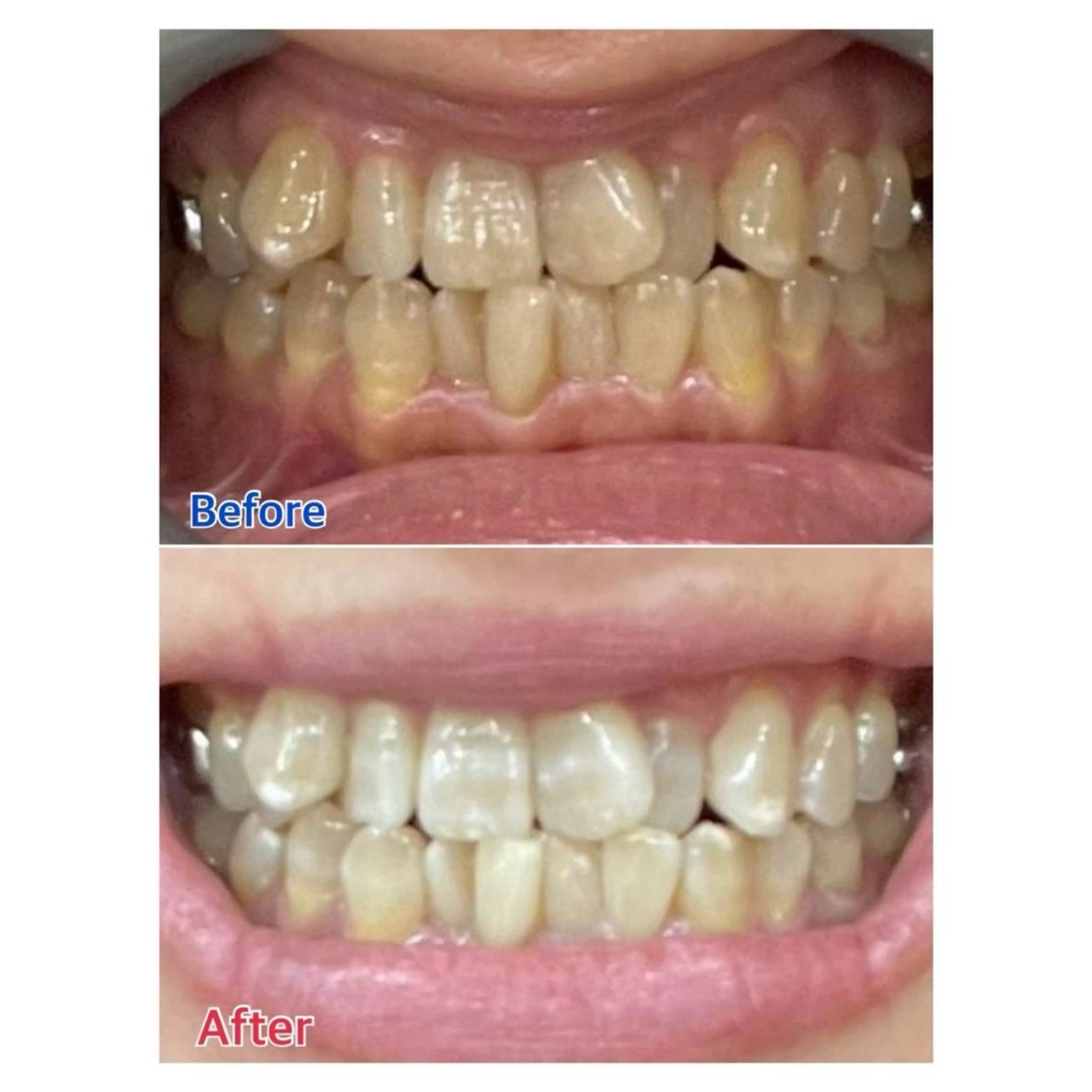 Melty 輝のその他イメージ