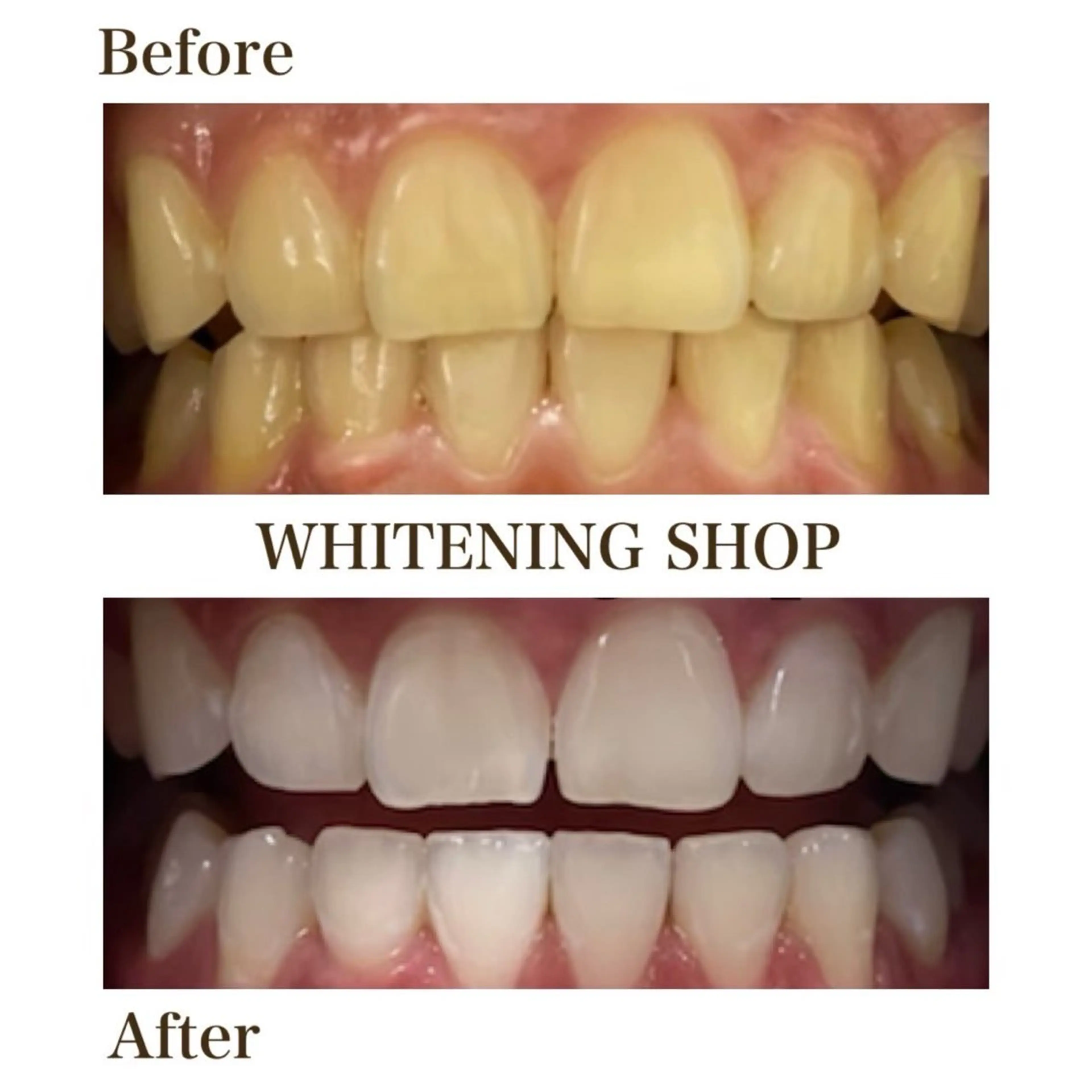 メンズ ホワイトニング ショップ葵区静岡駅店のその他イメージ