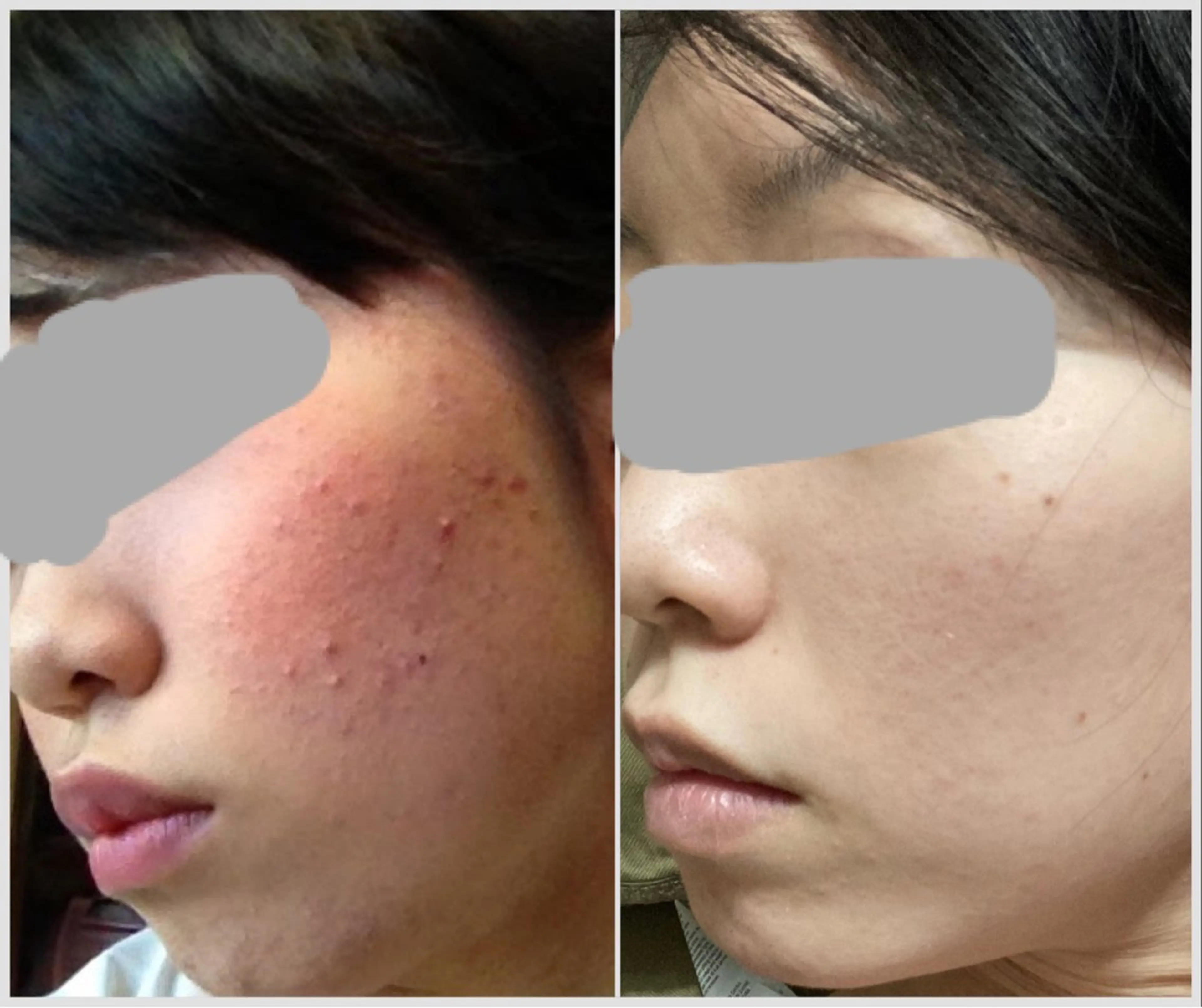 エステ 阿部 まなのエステ・リラクイメージ