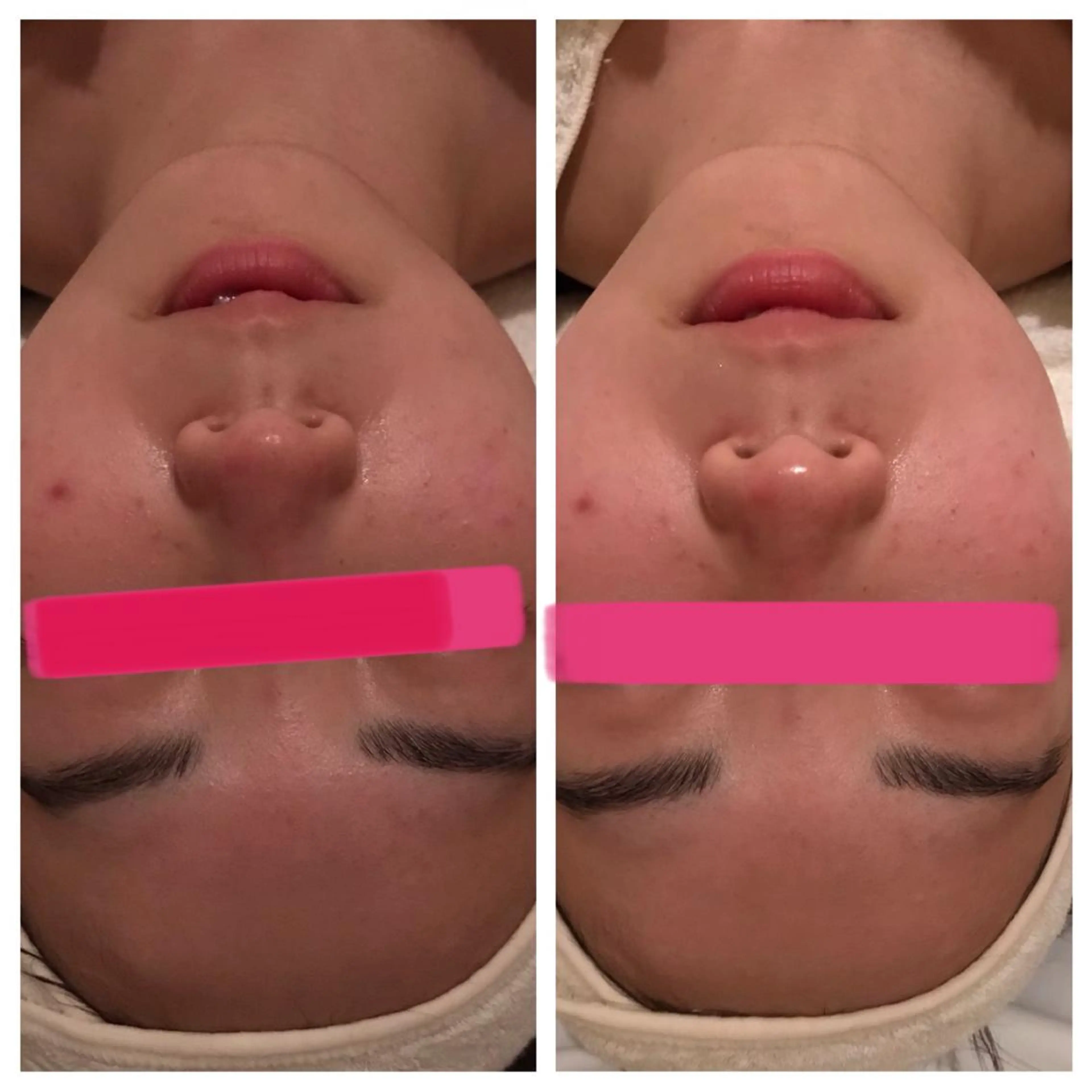 POLA大阪堀江店 小顔エステのエステ・リラクイメージ