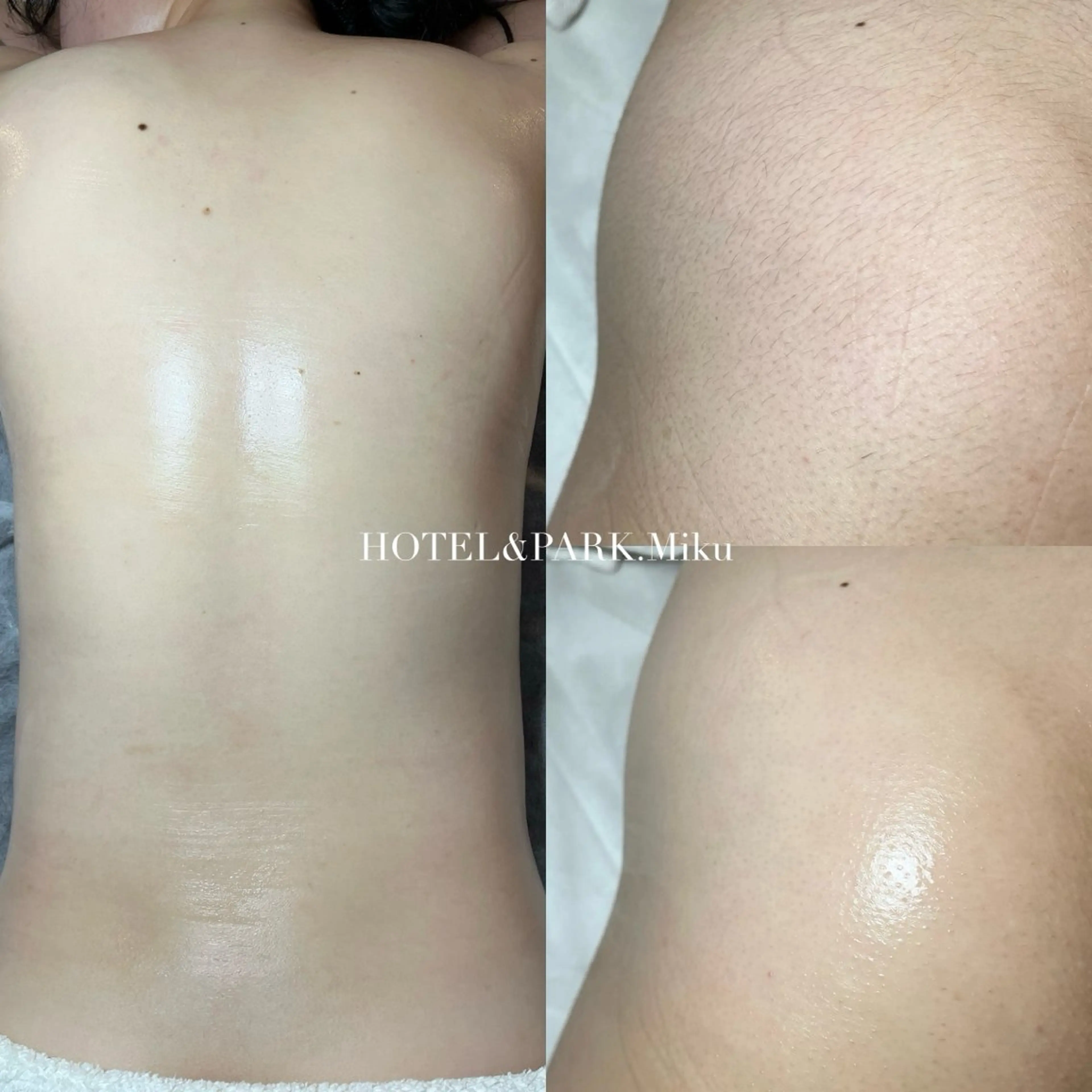 脱毛 HOTEL&PARK Mikuワックス脱毛のエステ・リラクイメージ