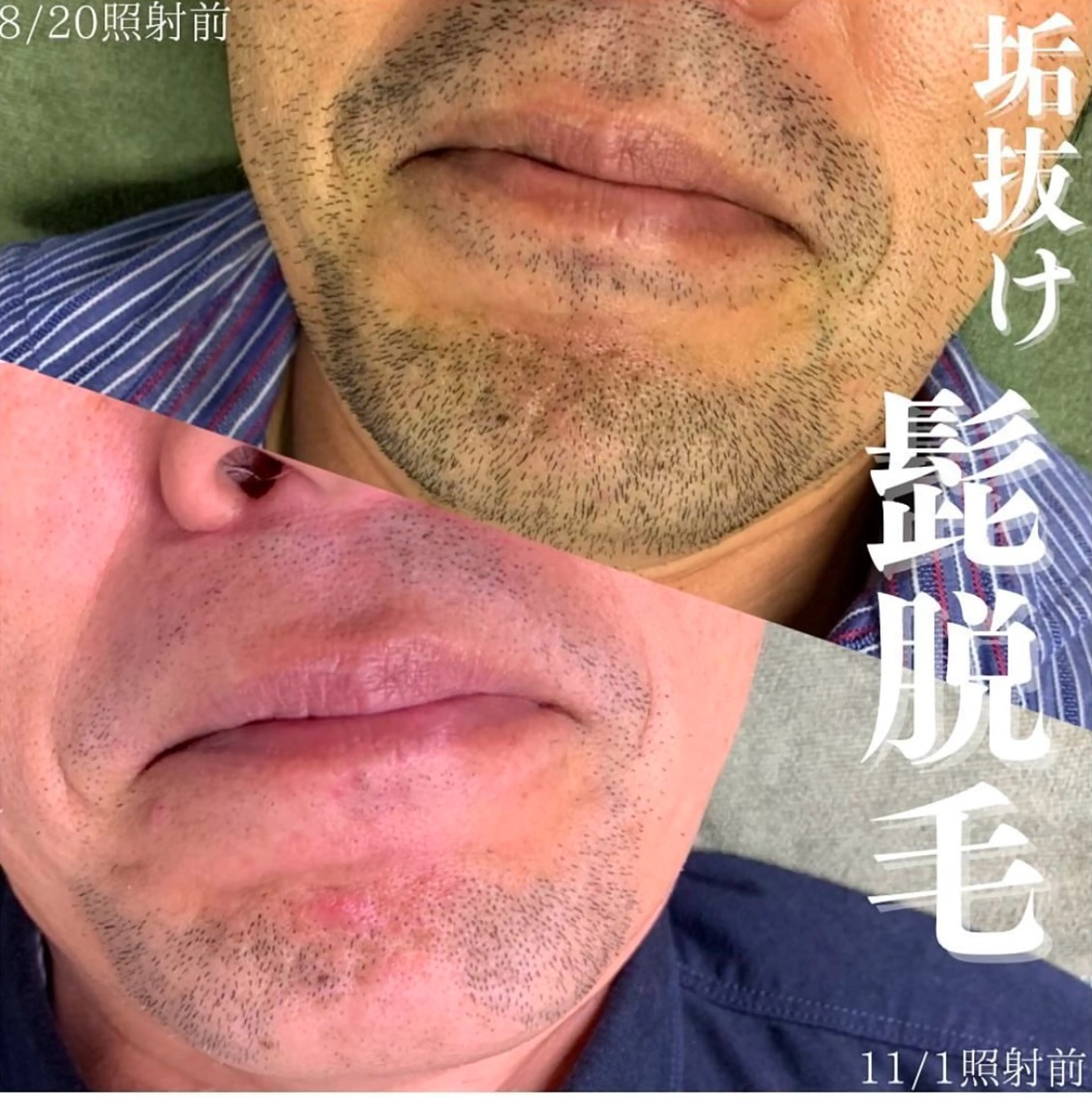 メンズ Bellmore ＋のエステ・リラクイメージ