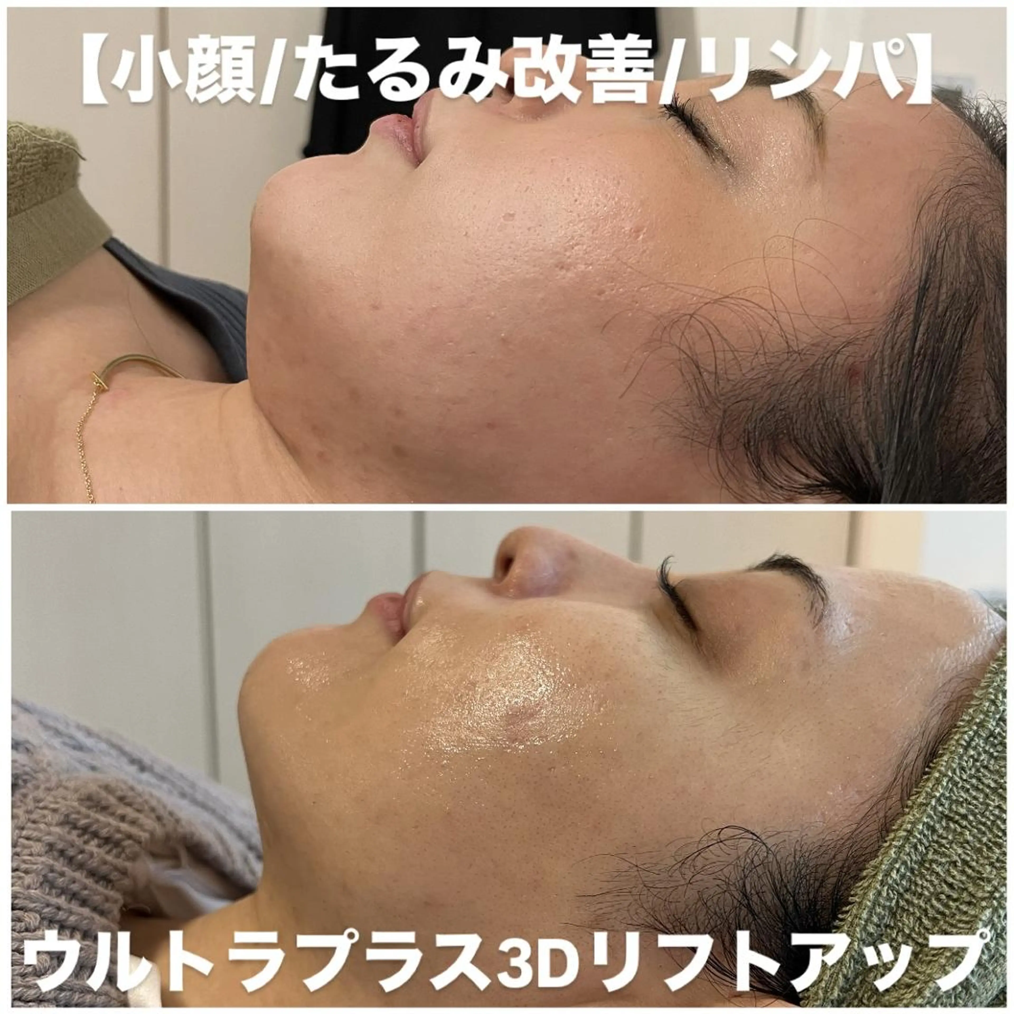 エステ リラク ビューティーサロン リノアのエステ・リラクイメージ