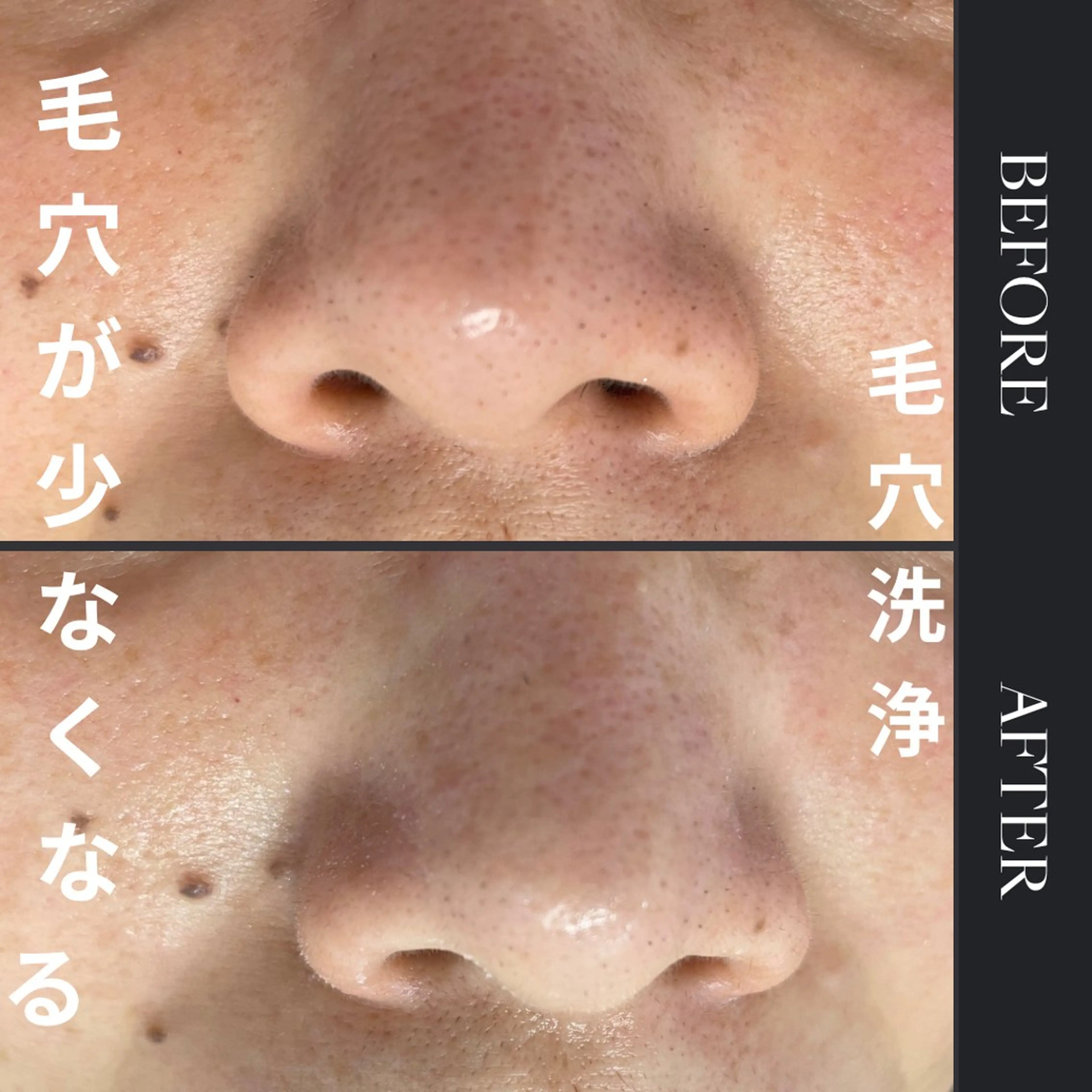 エステ une所属・une mizuhoの眉毛・アイブロウイメージ