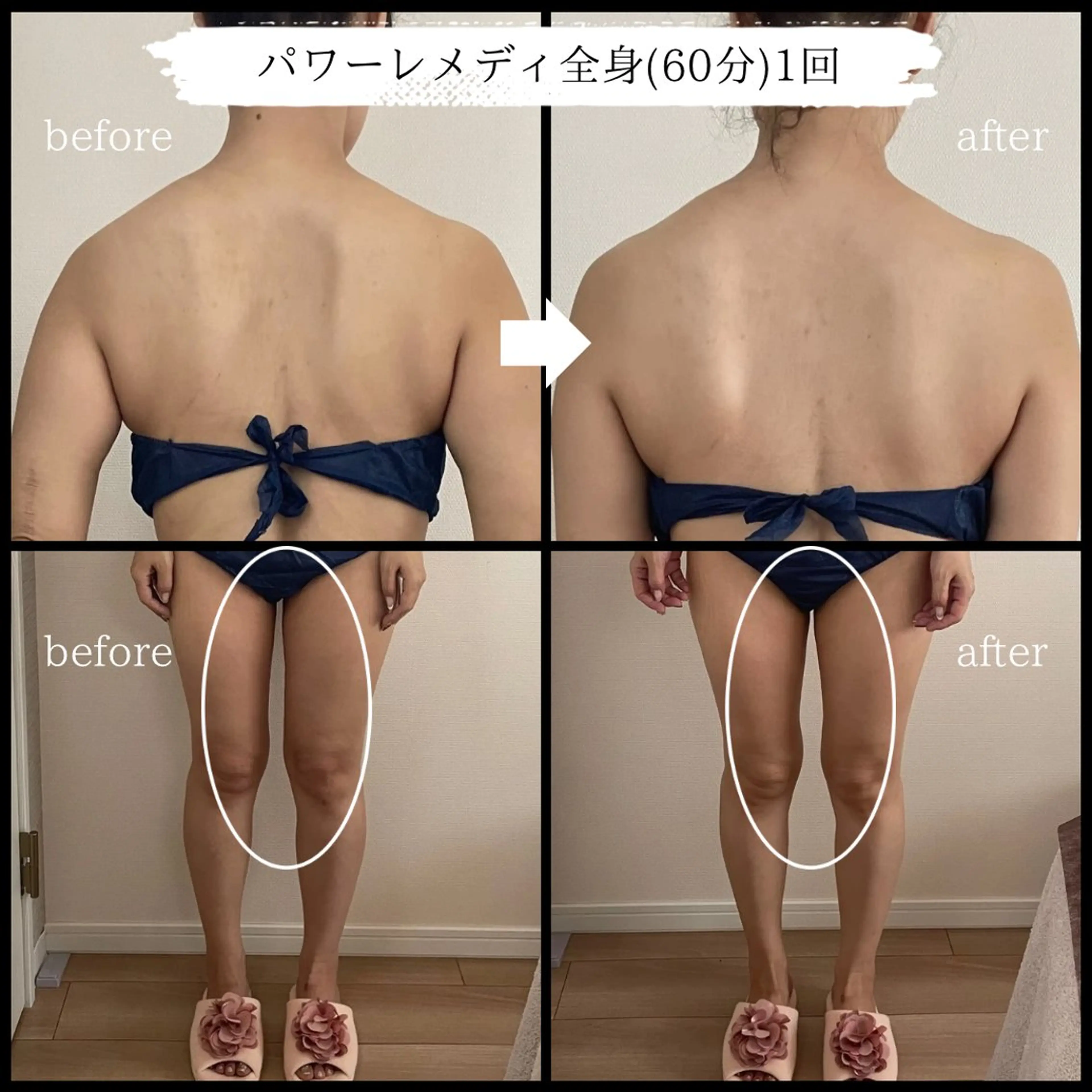 オフ:オン 全身筋膜マッサージのエステ・リラクイメージ