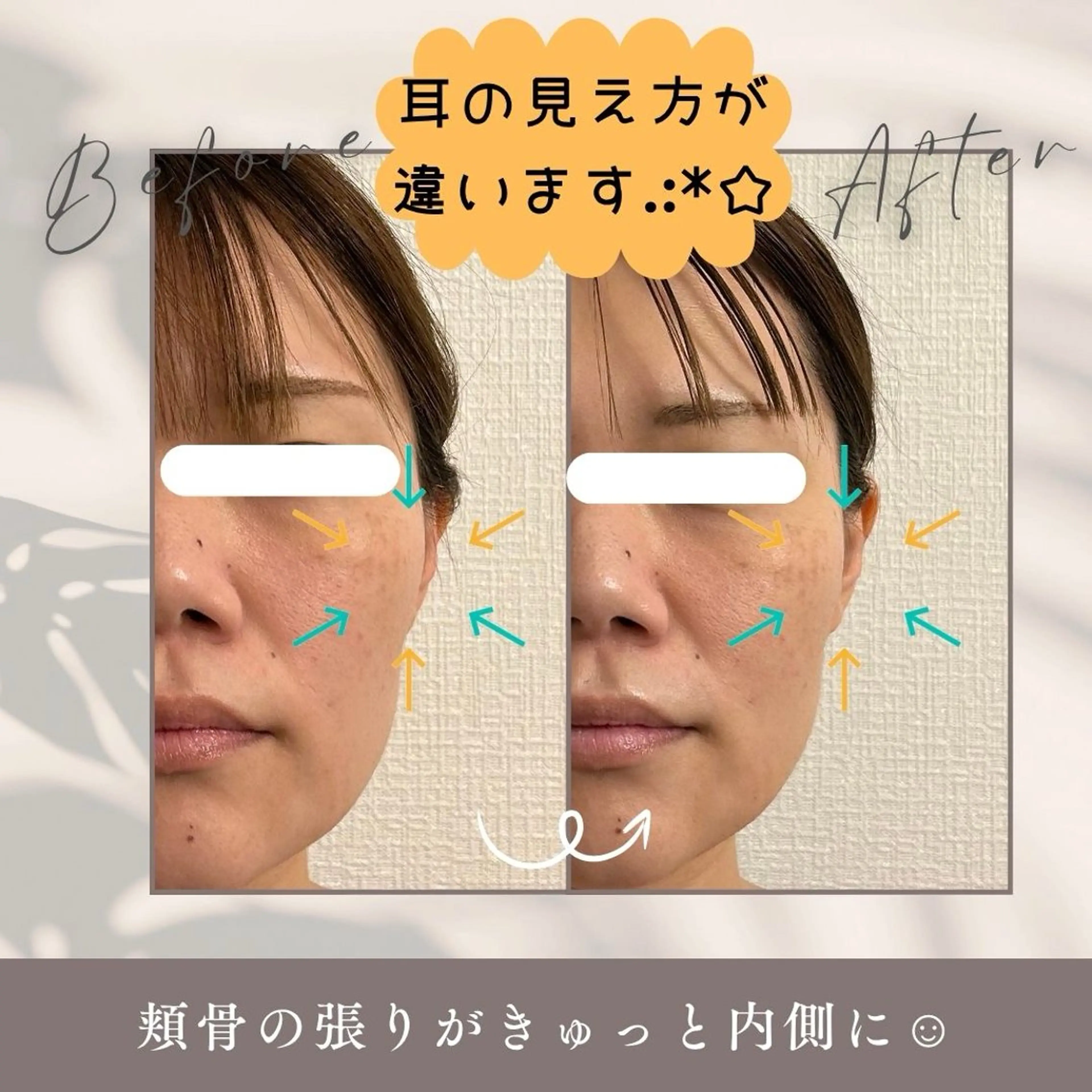 小顔セラピー LILのエステ・リラクイメージ