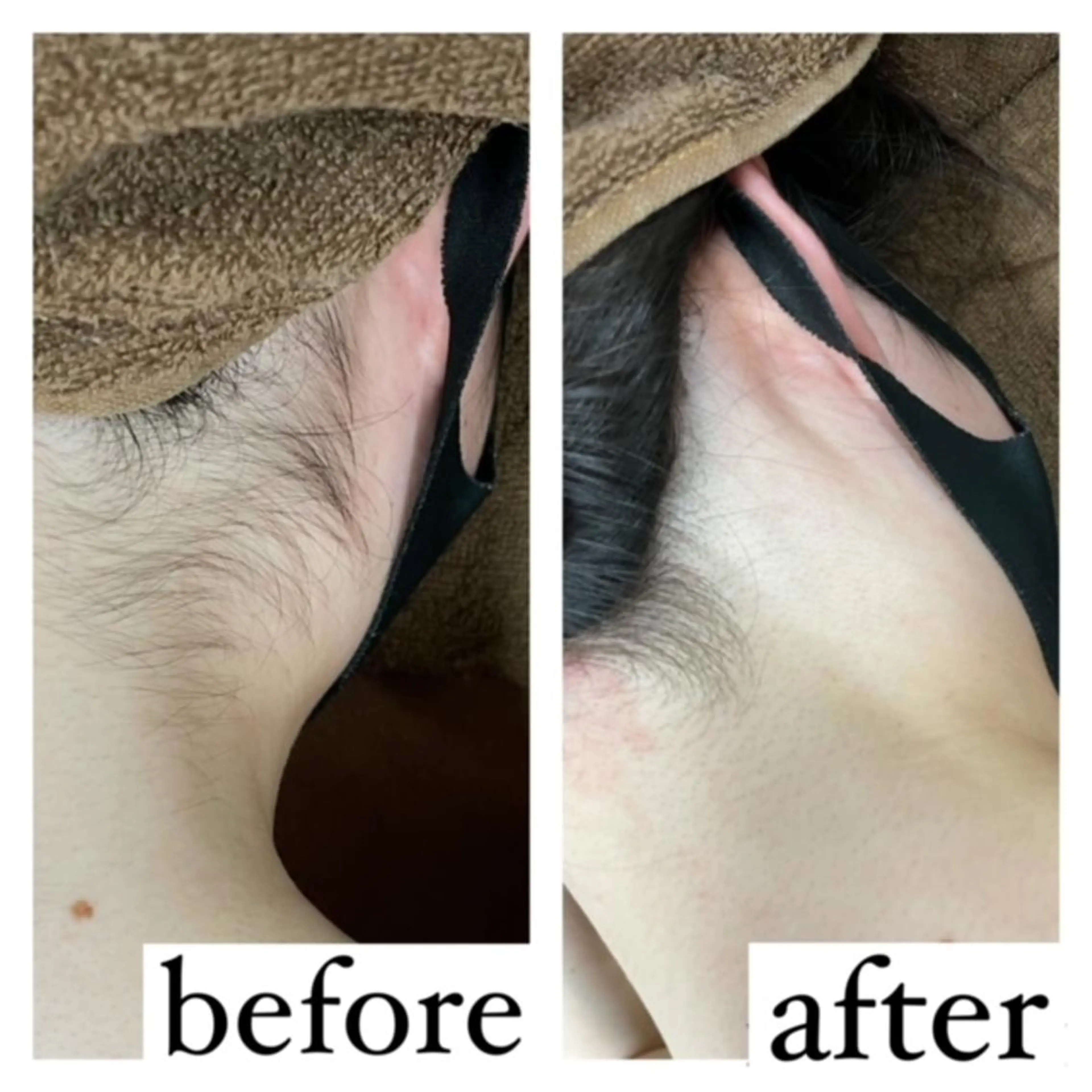 RinRin 甲府昭和店のエステ・リラクイメージ