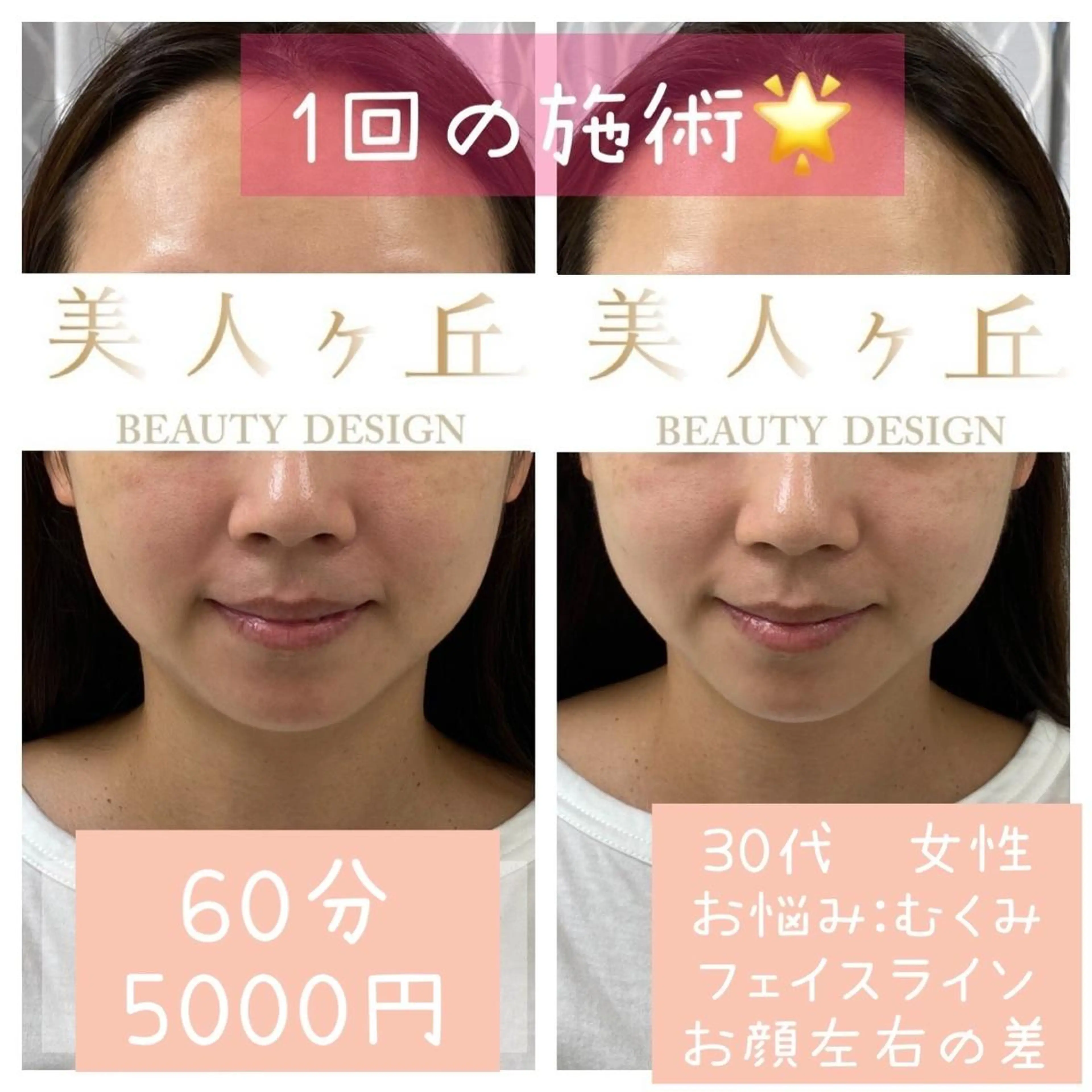 韓国/ヌーディー系 ネイル自由が丘のネイルデザイン