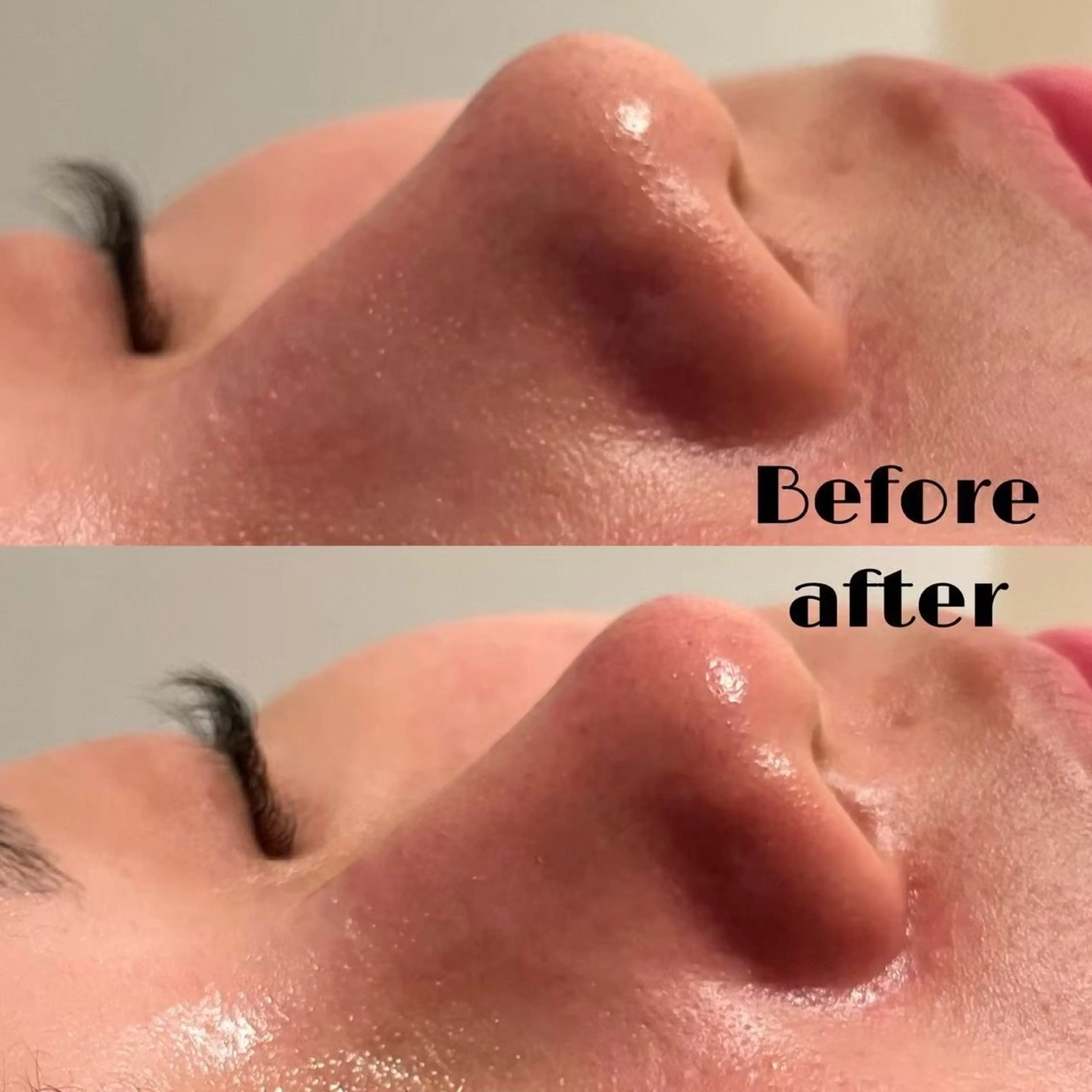 LUMIERE(ルミエル)福岡春吉店所属・LUMIERE 福岡のエステ・リラクイメージ