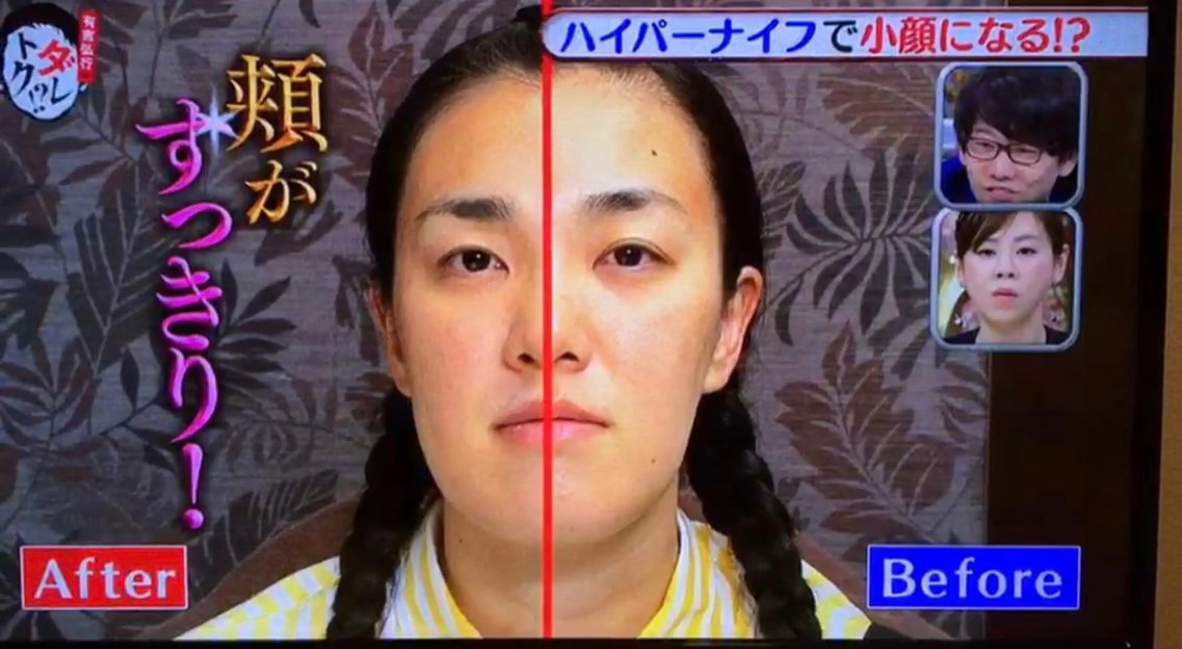 ワックス脱毛 ♡AYO♡のエステ・リラクイメージ