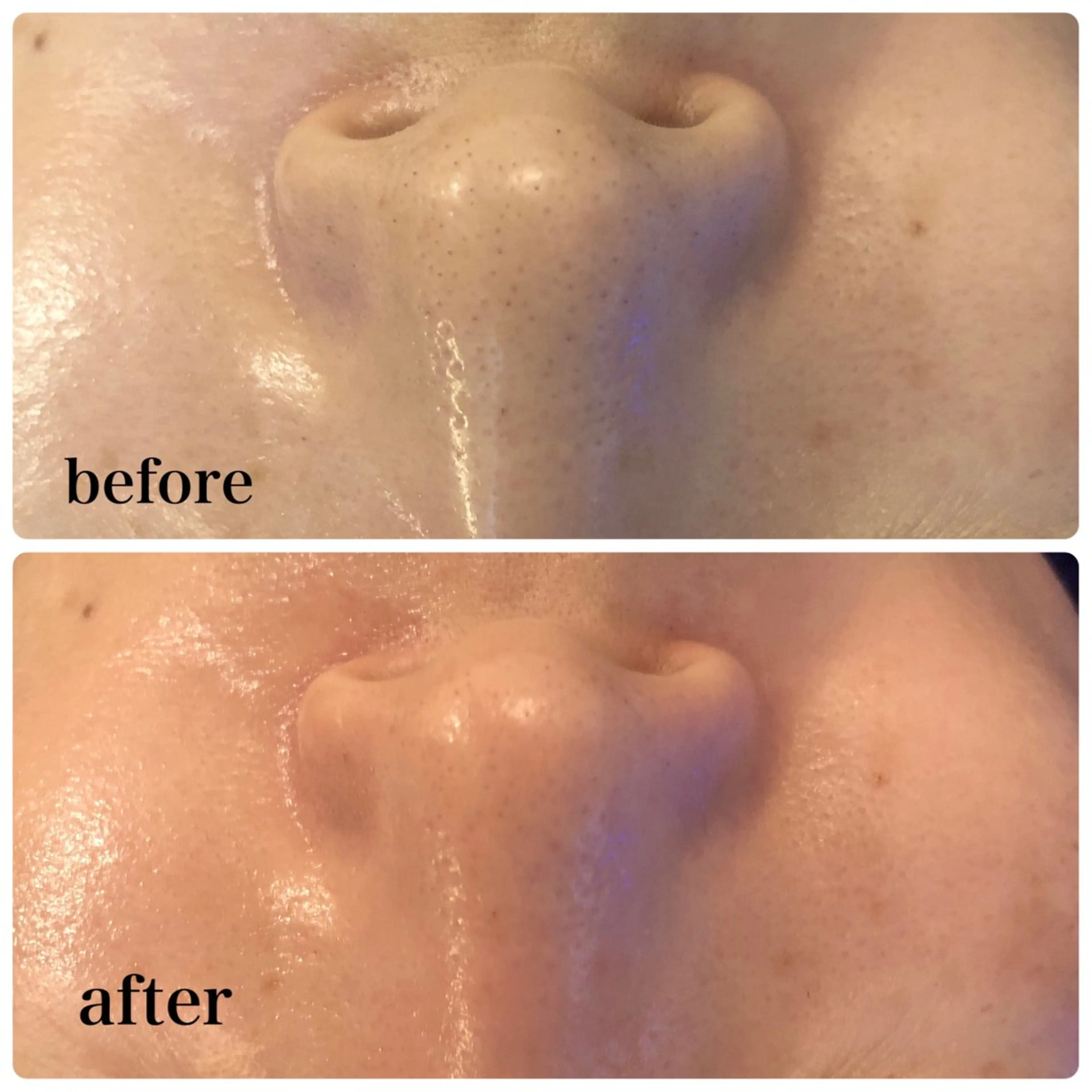 Salon de cheri サロンドシェリ人形町店所属・毛穴のお悩み・シミ 松本瞳のエステ・リラクイメージ