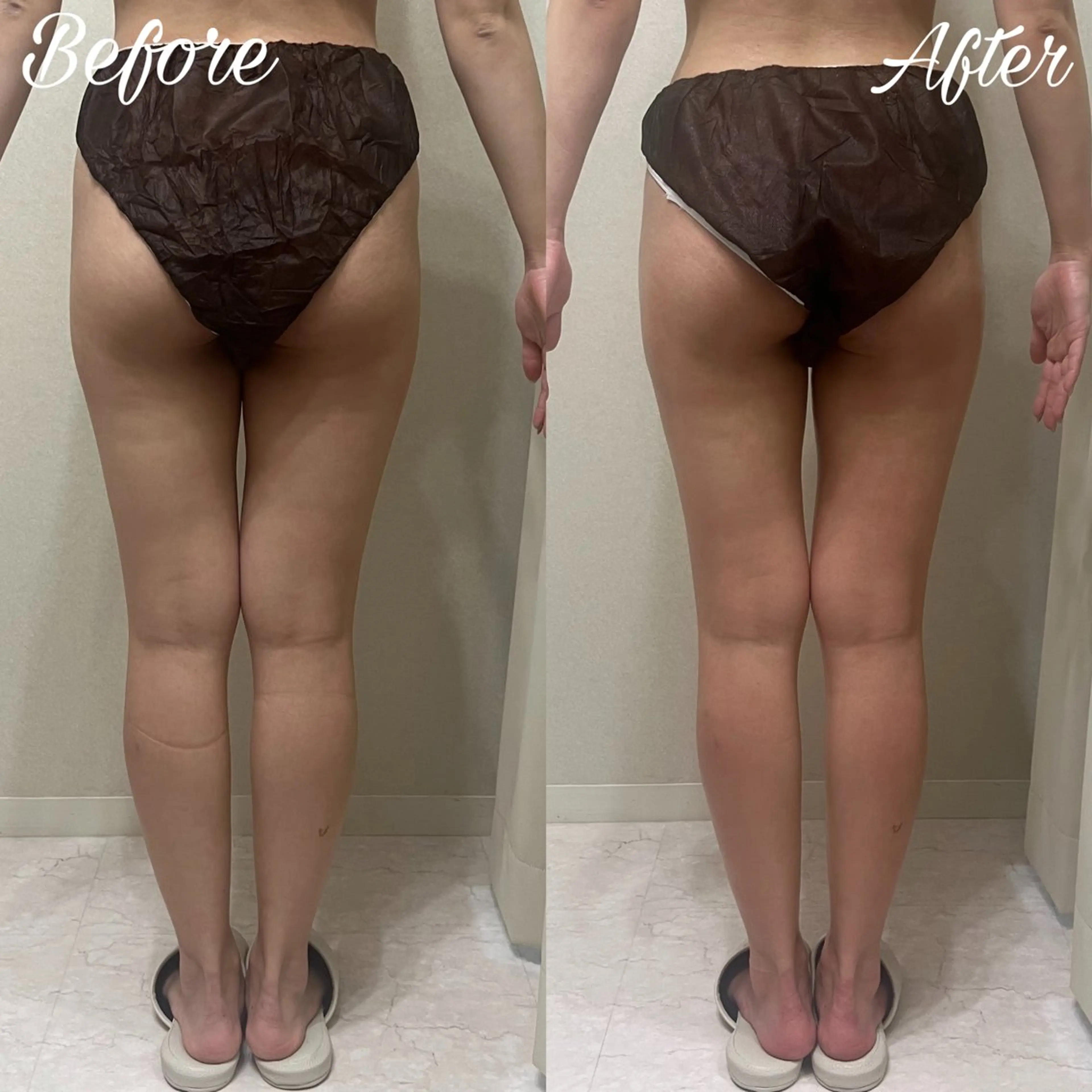 aimer 島田のエステ・リラクイメージ