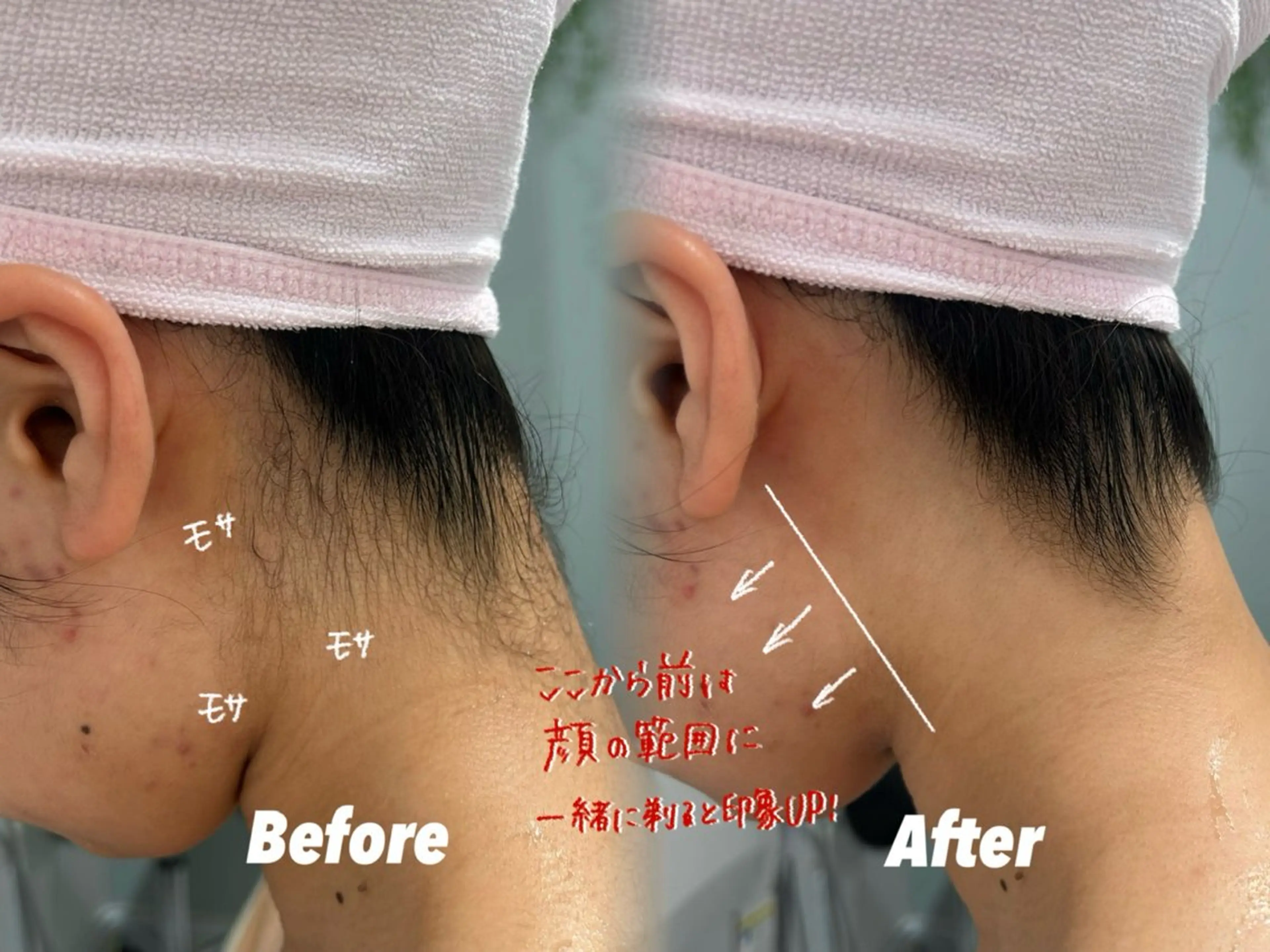 エステ 🫧美しい素肌へ🫧 今成柚乃のその他イメージ