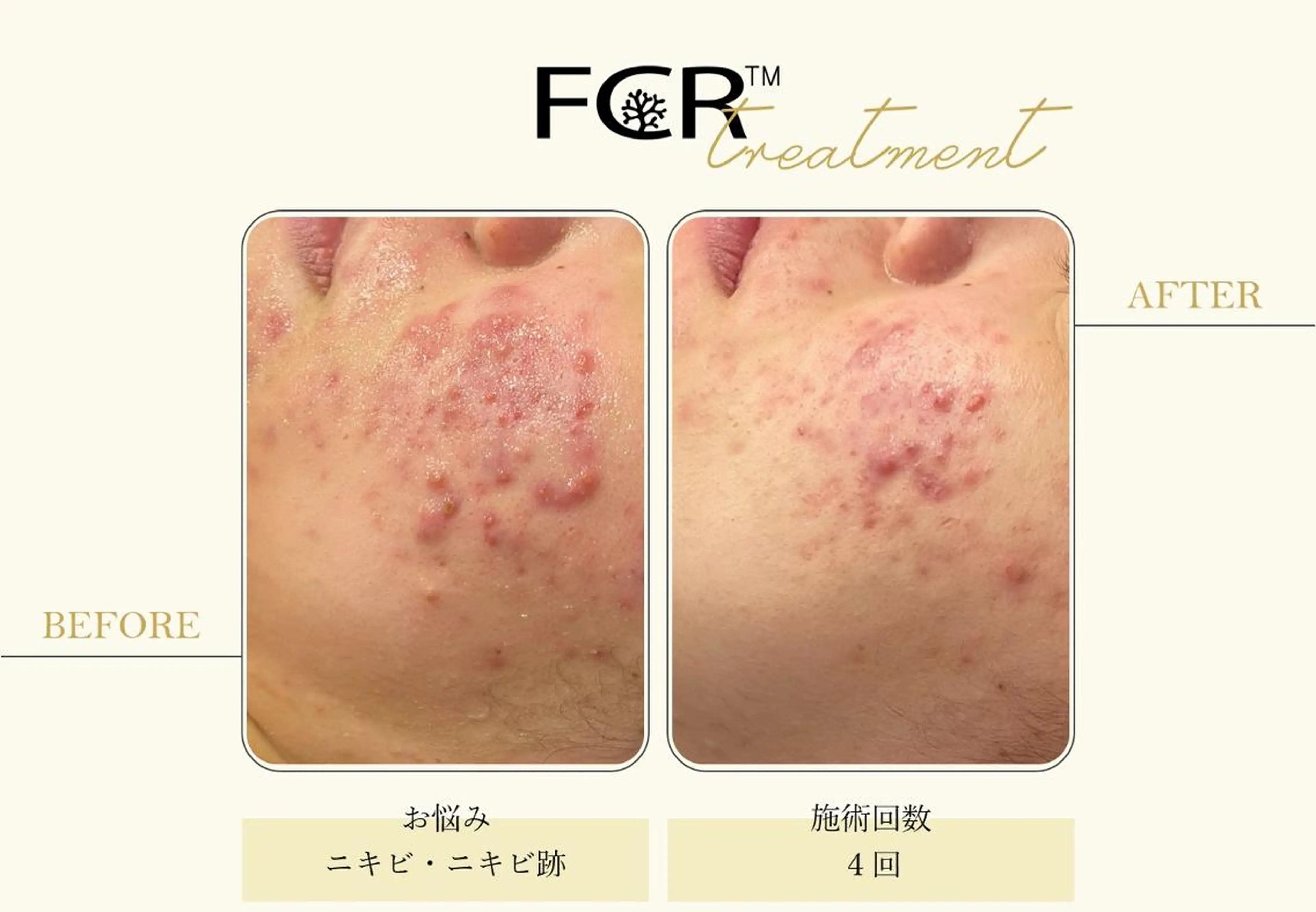 ララピール銀座 小顔フェイシャルのエステ・リラクイメージ