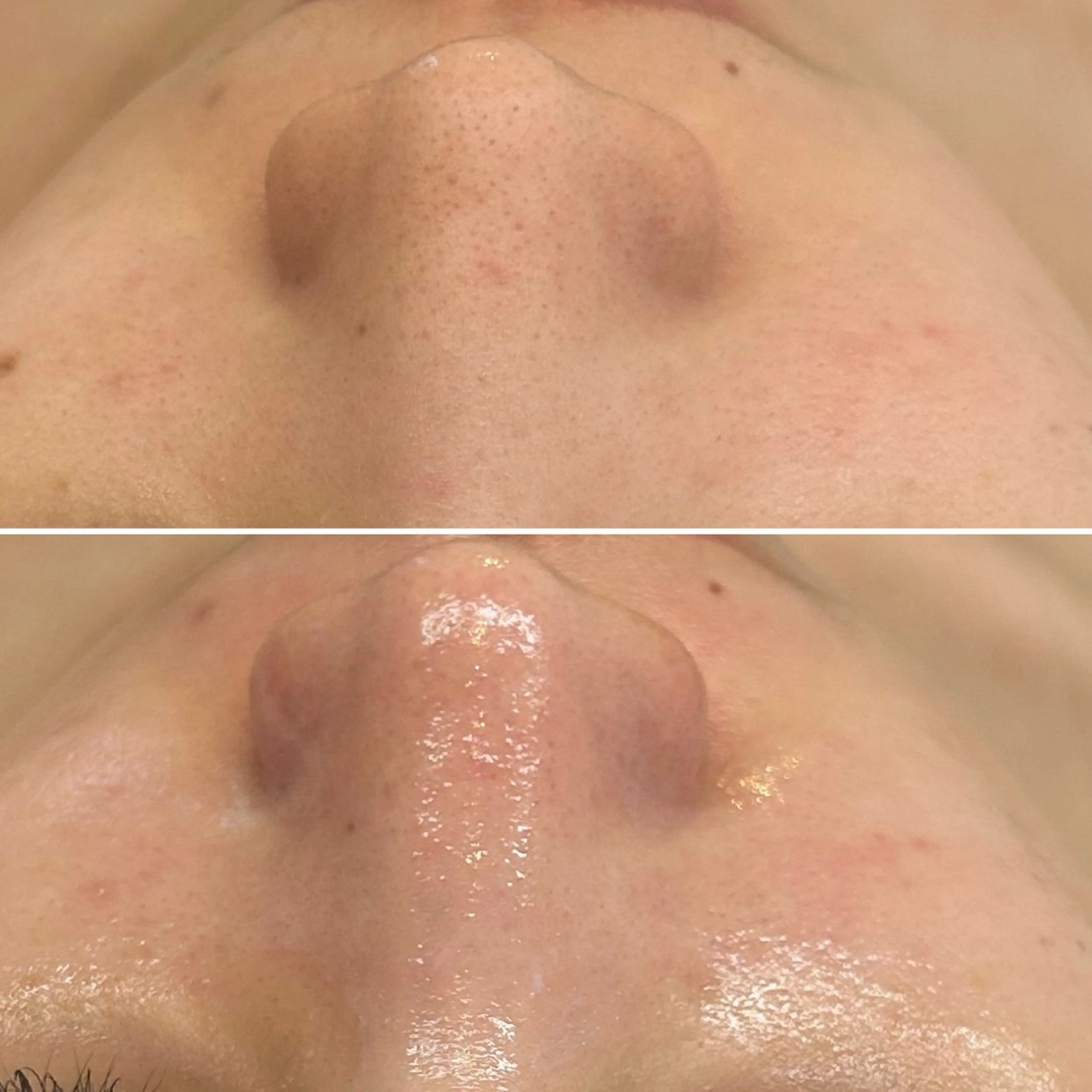 エステ 韓国🇰🇷価格 サロン_Nbibiの眉毛・アイブロウイメージ