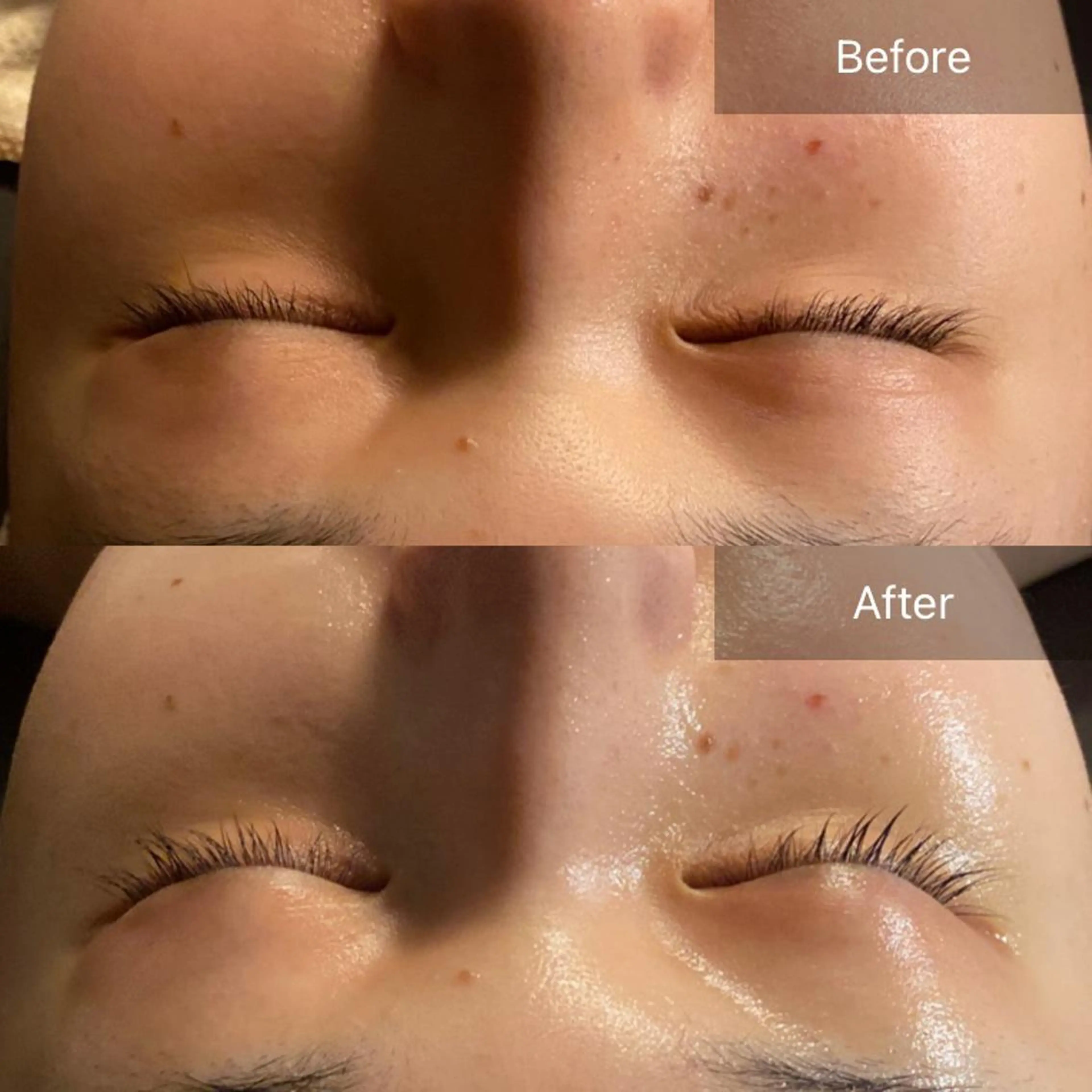 Mandarin Orange所属・毛穴から始める肌メン テマンダリンオレンジのエステ・リラクイメージ