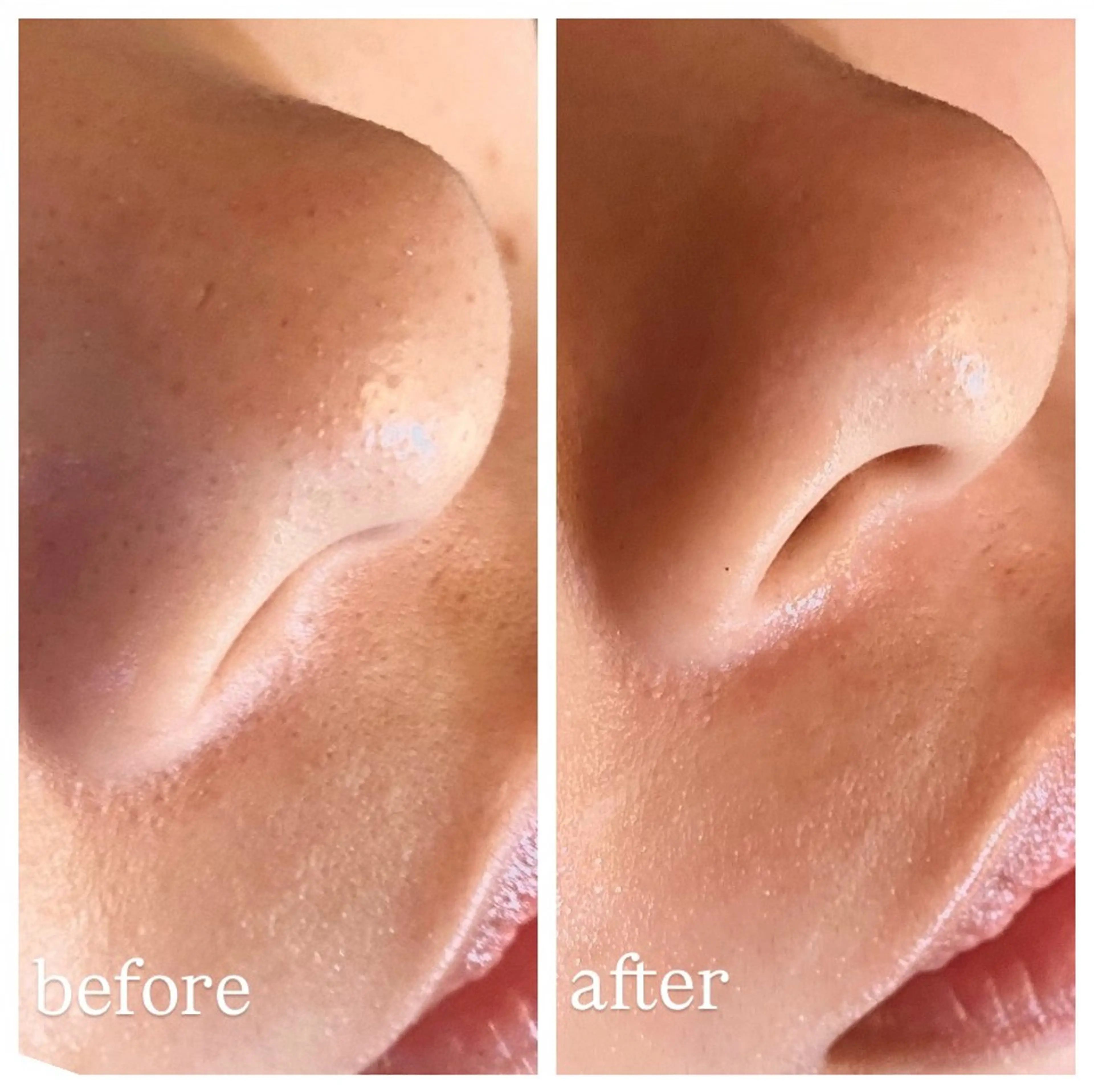 エステ 肌質改善専門 ハーブ /毛穴洗浄 リエイトのエステ・リラクイメージ