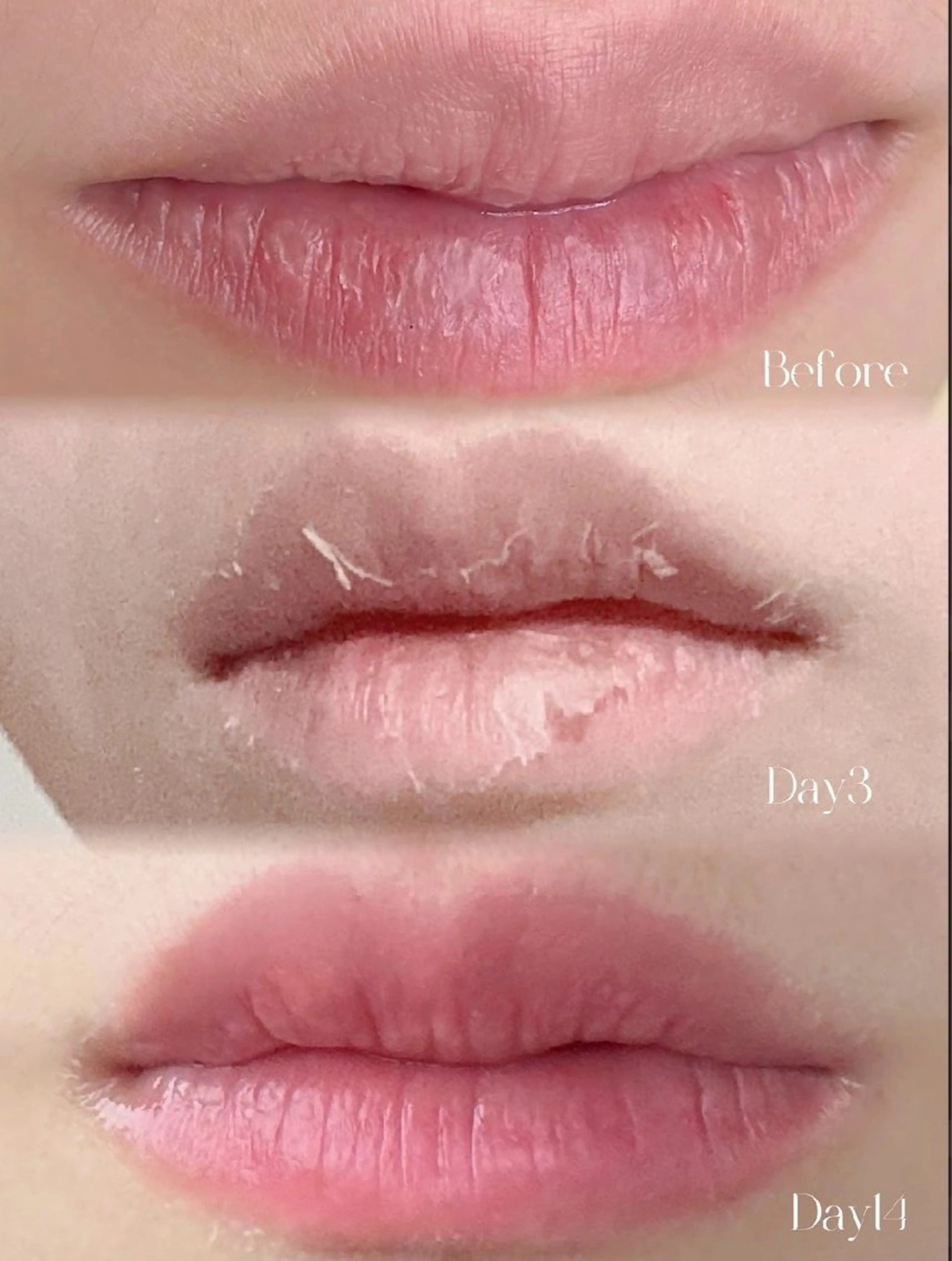 M渋谷 ホワイトニングのエステ・リラクイメージ