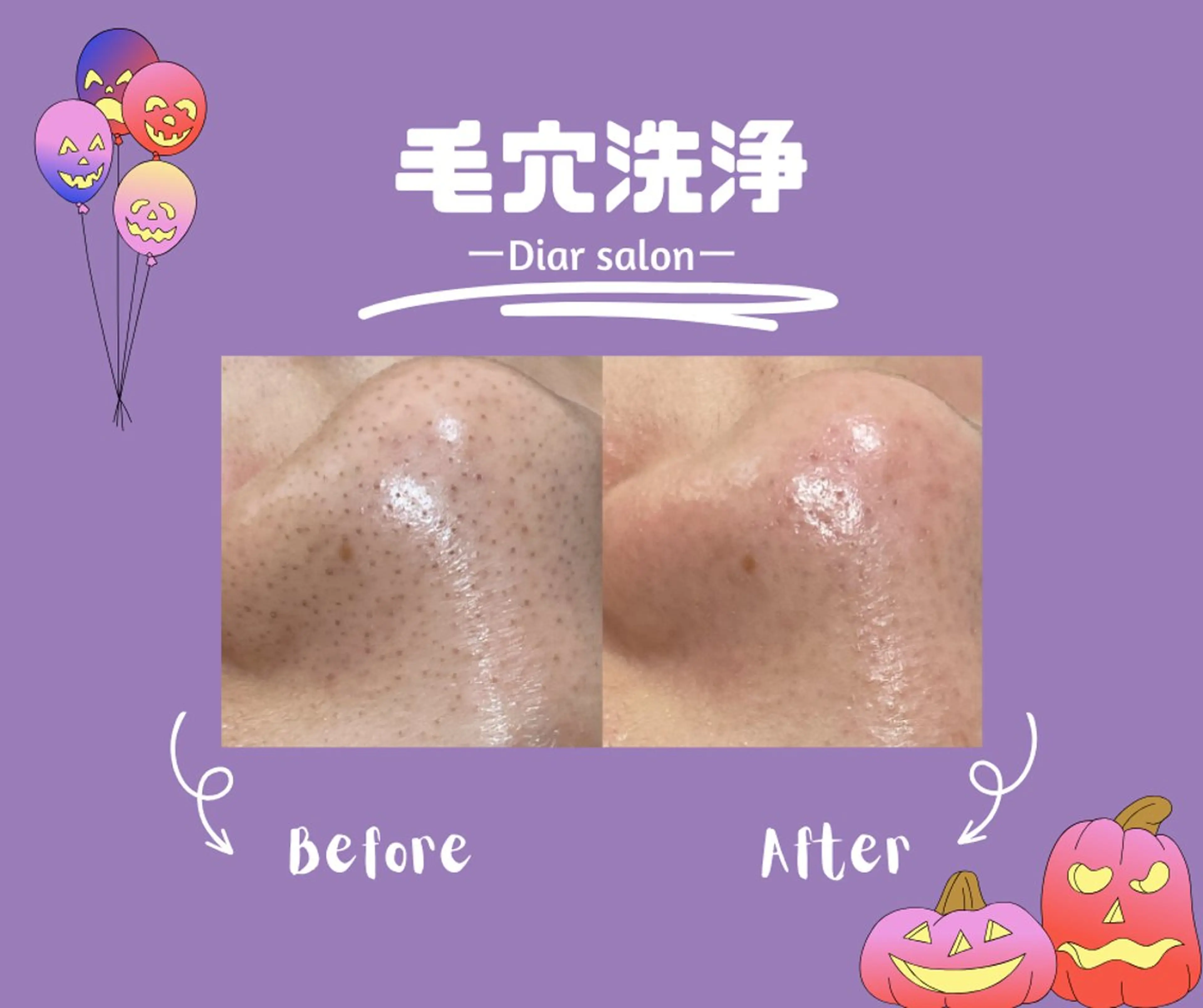 脱毛 【Diar】オーナー アキヨシケンタのヘアスタイル