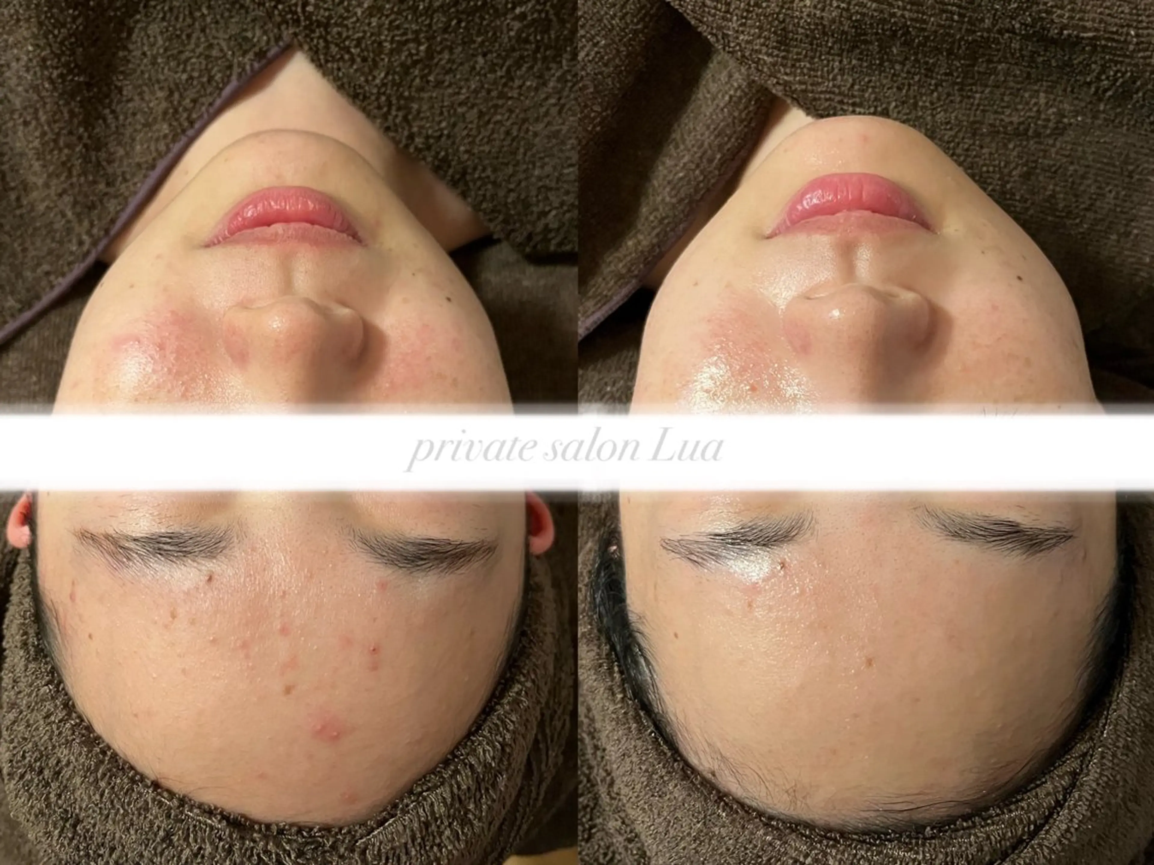 salon Lua🌛のエステ・リラクイメージ