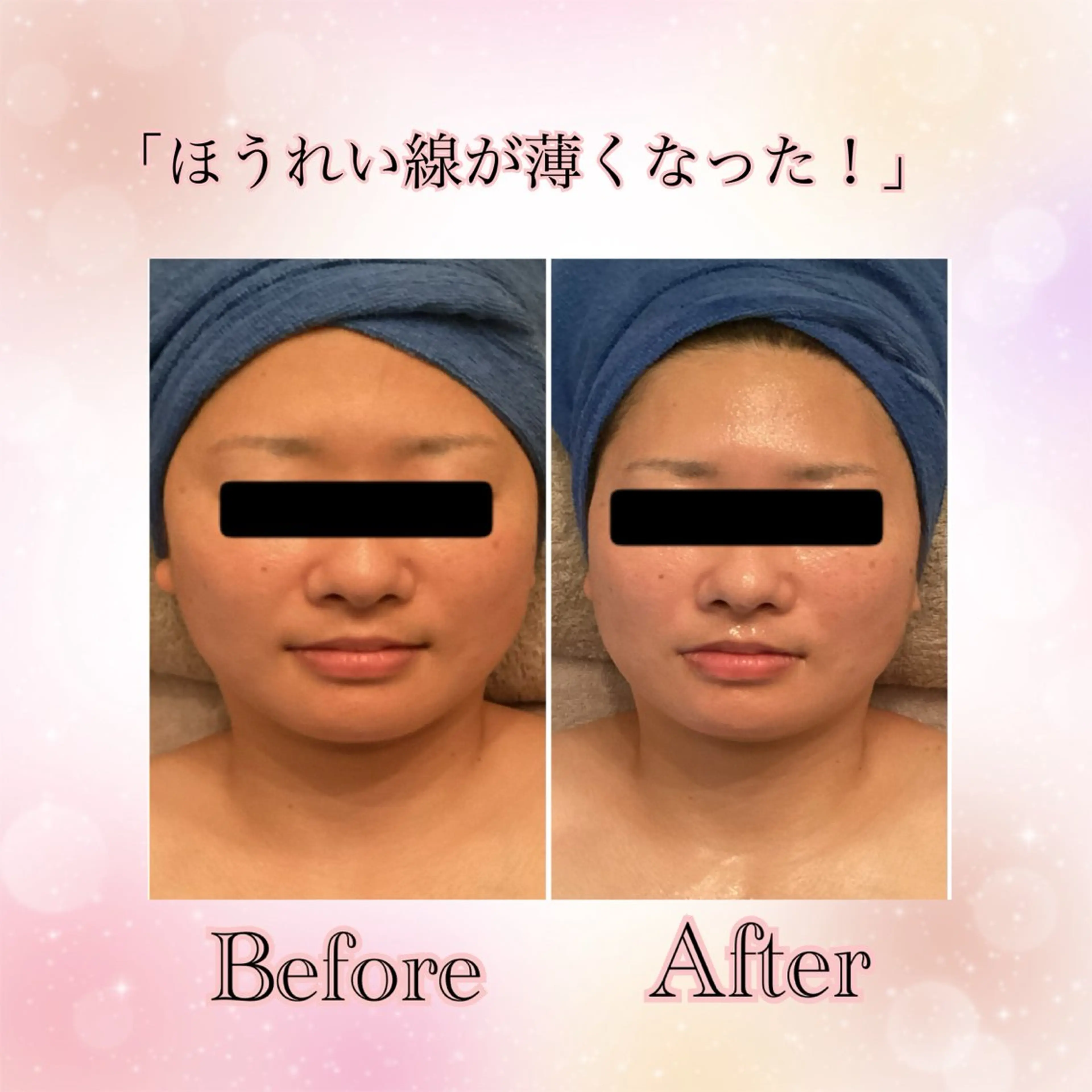 ラトゥール Maiのエステ・リラクイメージ