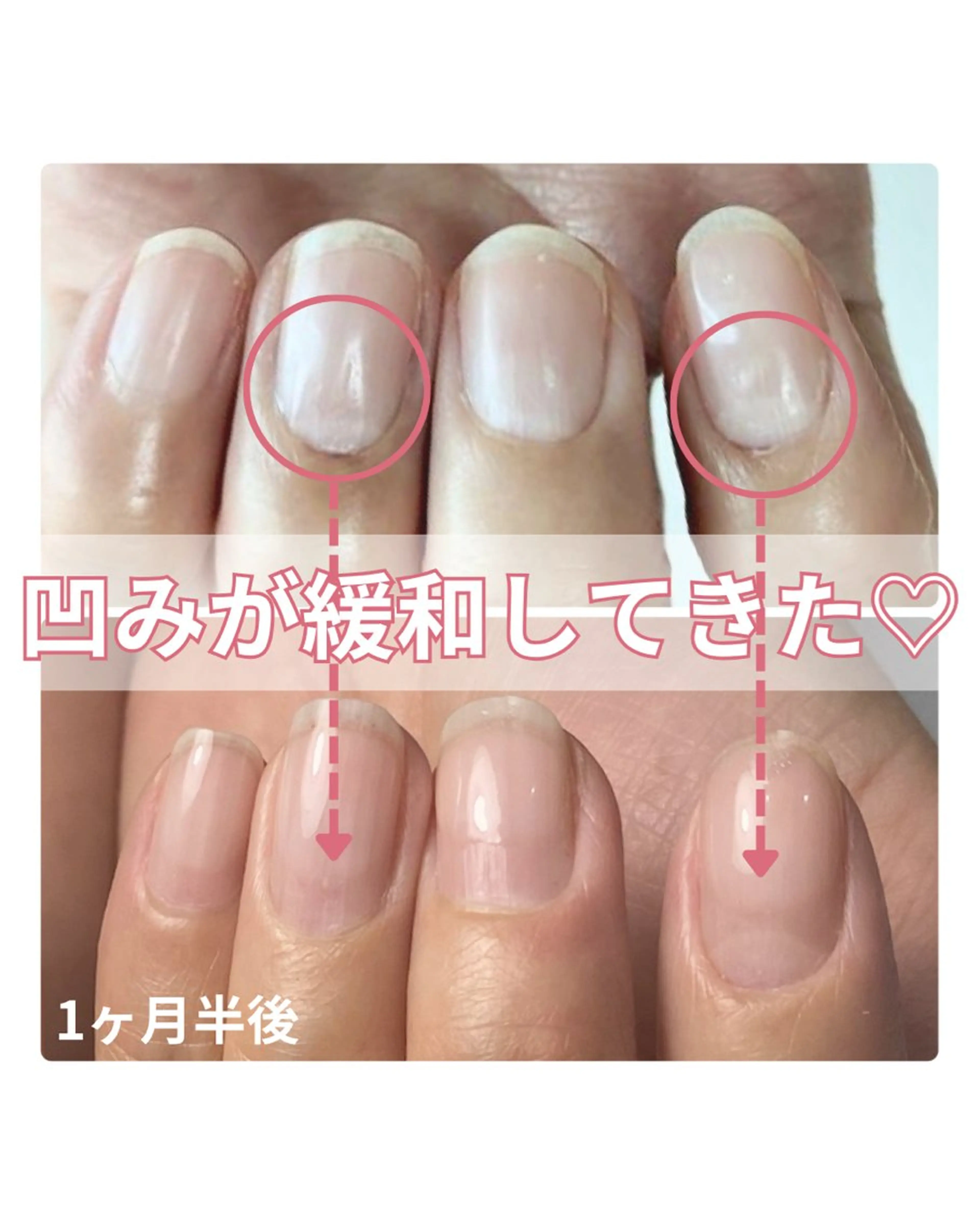 ネイル 自爪育成nail fachuriのネイルデザイン