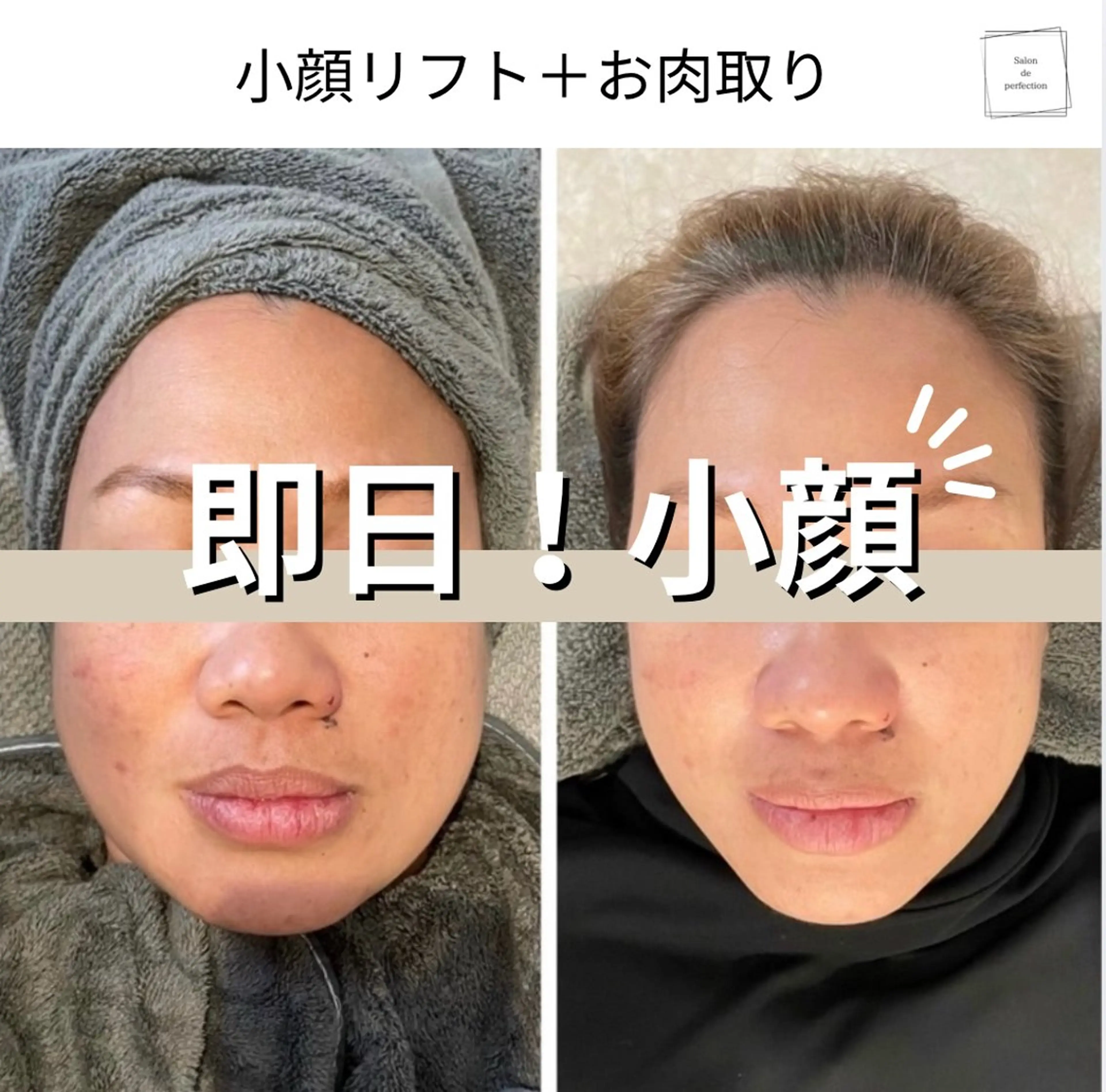 エステ salon de perfectionのエステ・リラクイメージ